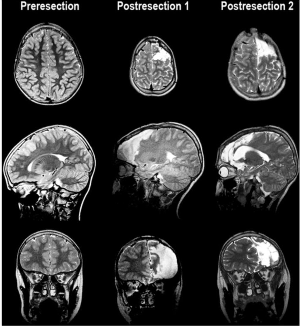 Brainsci 03 01597 g001 1024