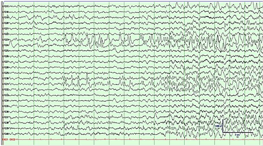 Brainsci 03 01597 g004 1024