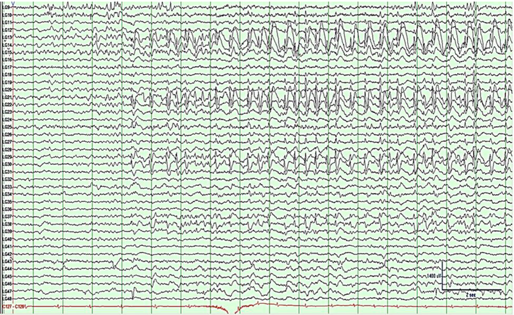 Brainsci 03 01597 g007 1024