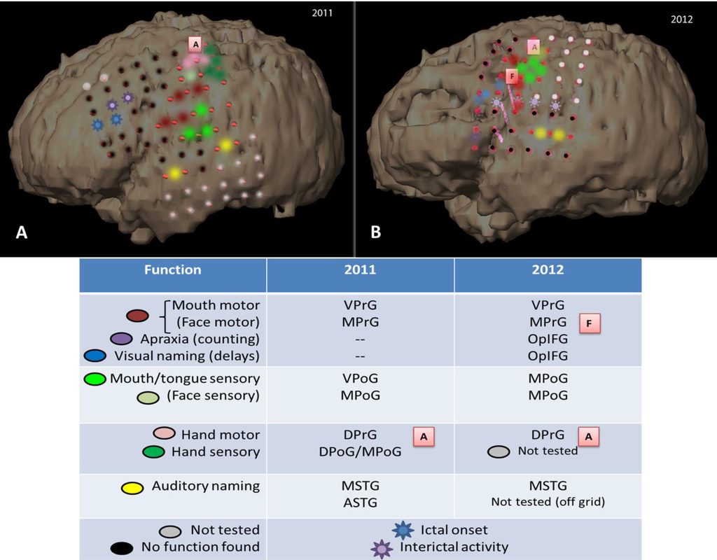 Brainsci 03 01597 g009 1024