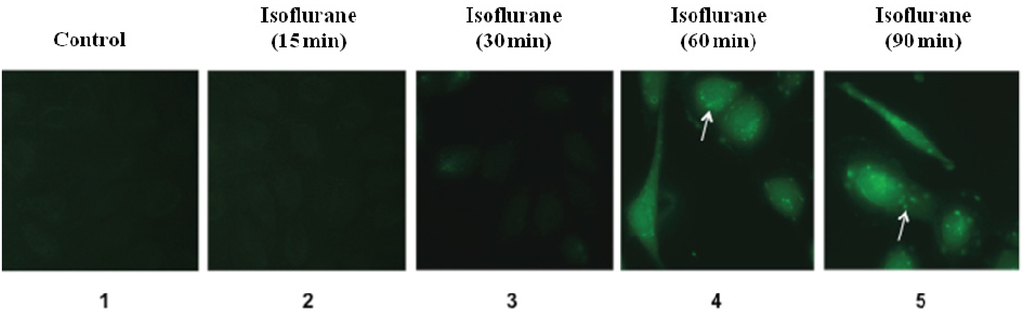 Brainsci 04 00311 g001 1024