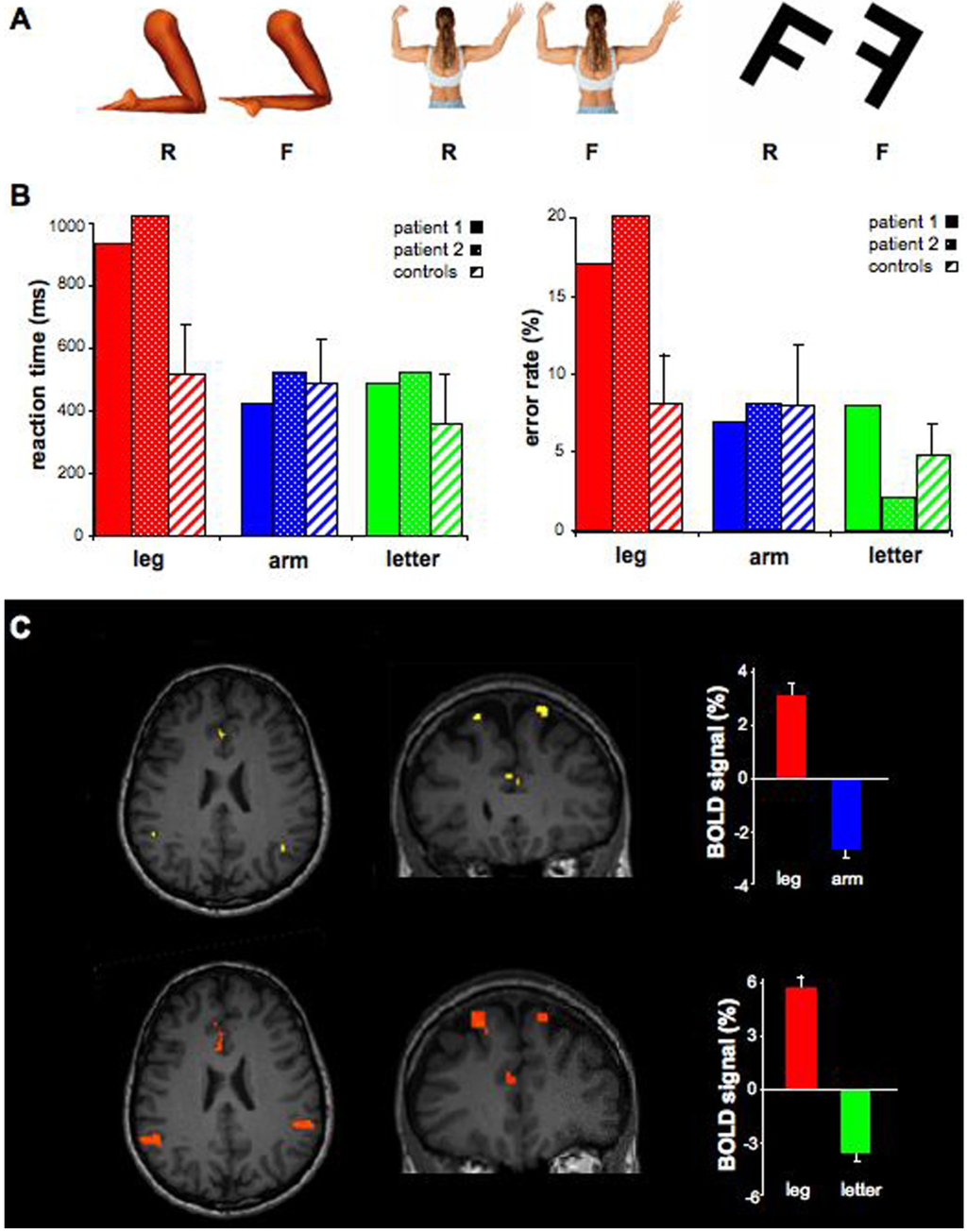 Brainsci 04 00396 g002 1024