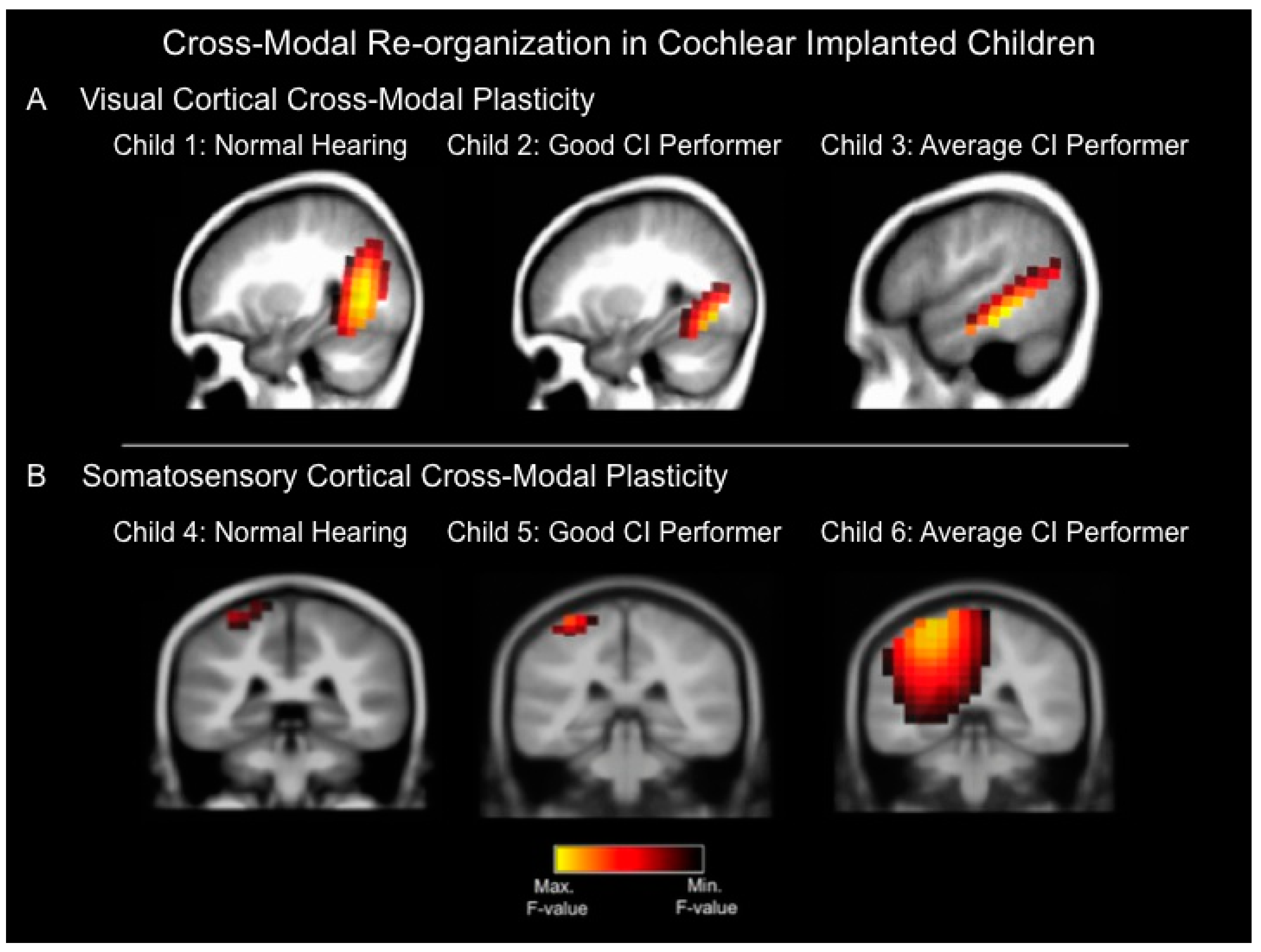 Brainsci 06 00004 g001