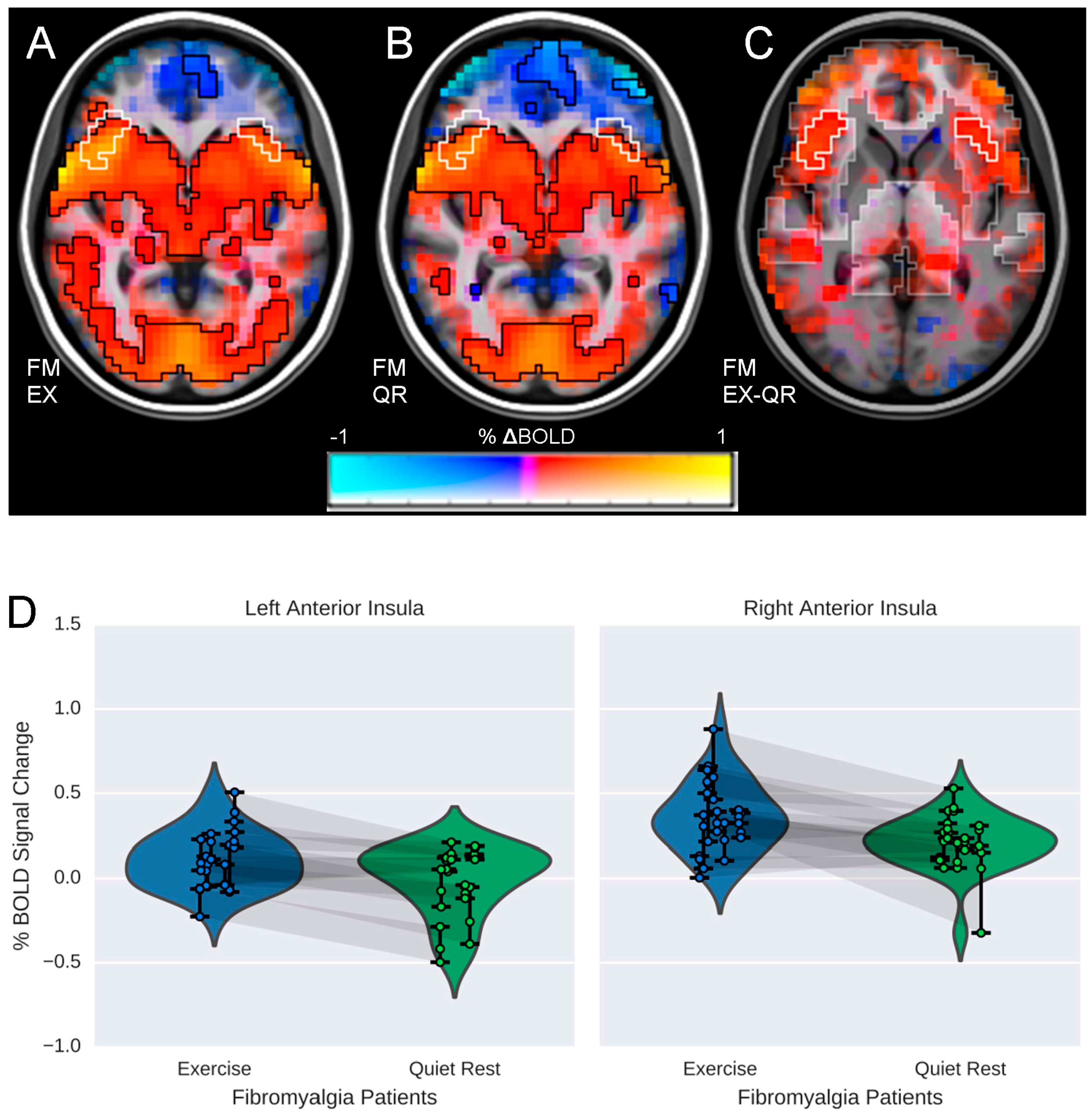 Brainsci 06 00008 g002