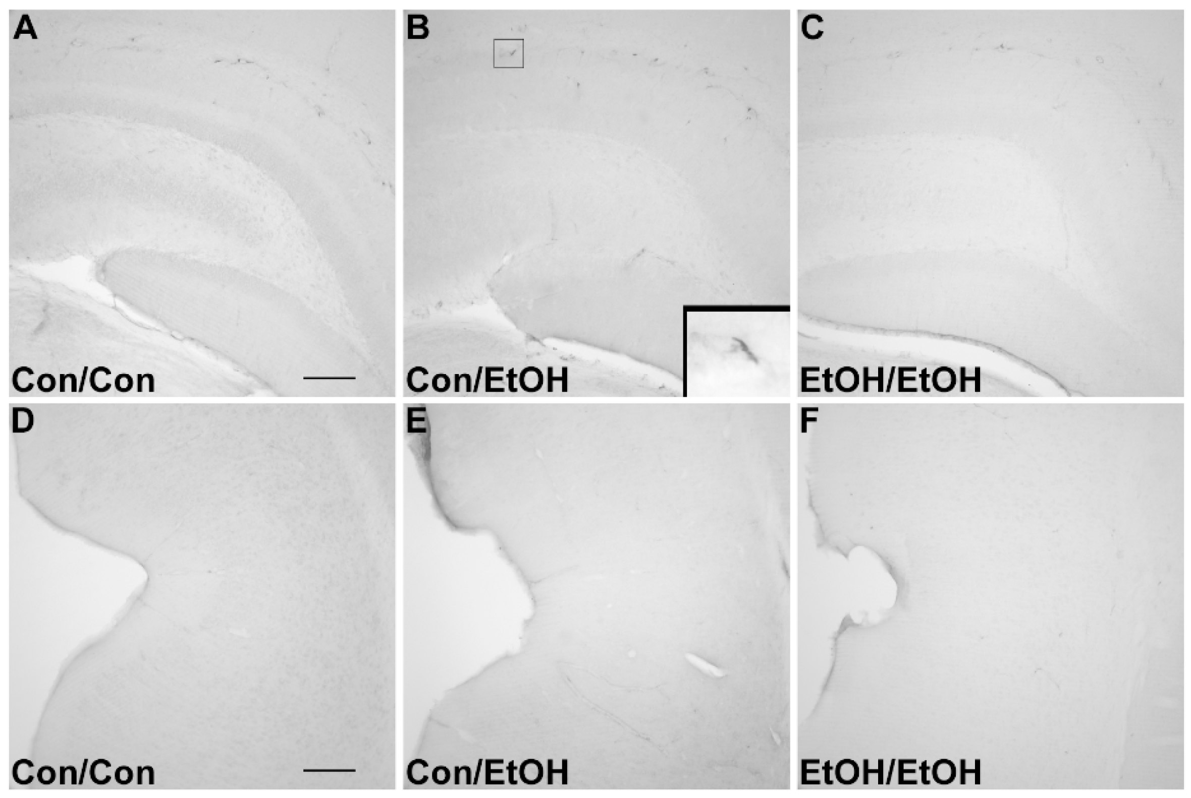 Brainsci 06 00016 g003