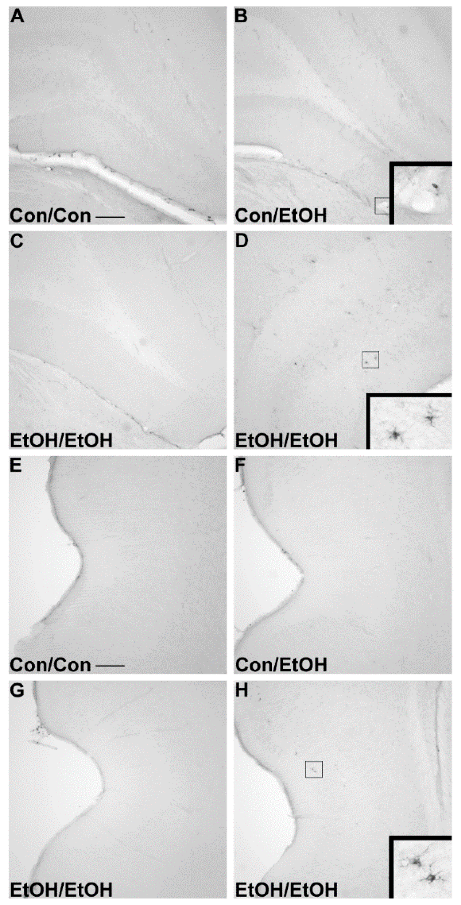 Brainsci 06 00016 g004