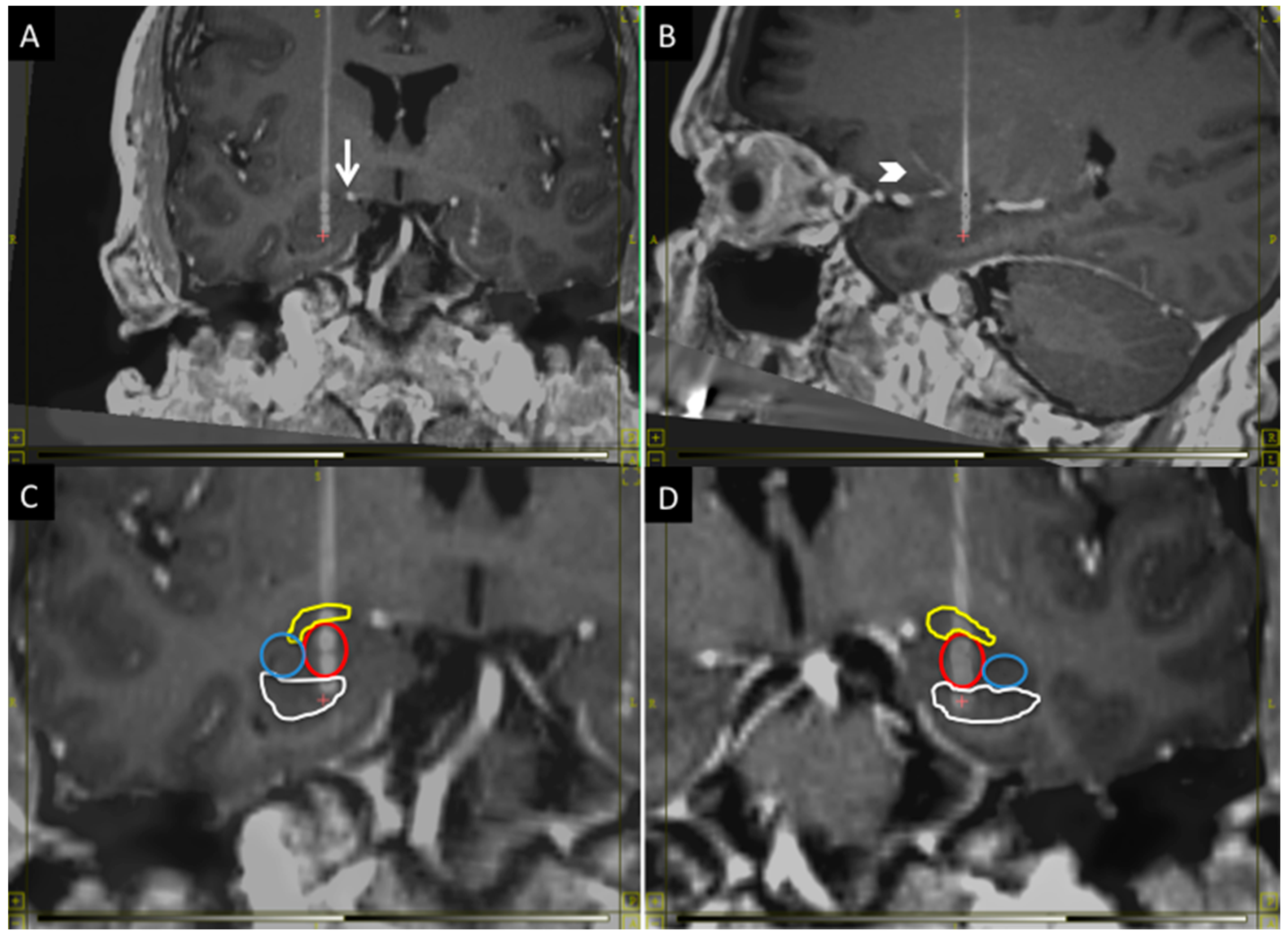 Brainsci 06 00028 g001