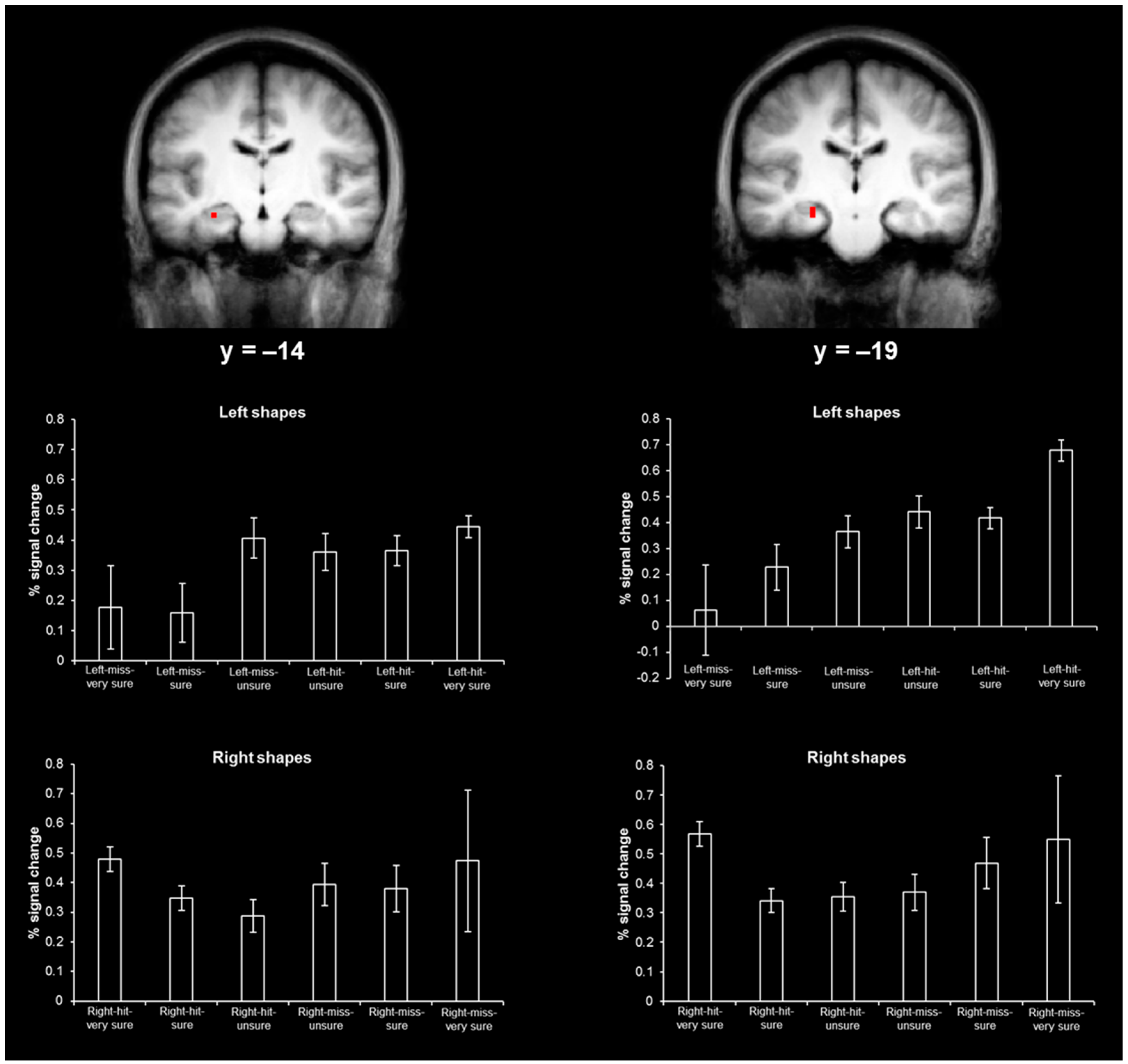 Brainsci 06 00037 g004