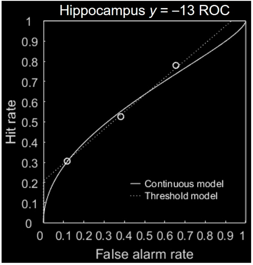 Brainsci 06 00037 g007 1024