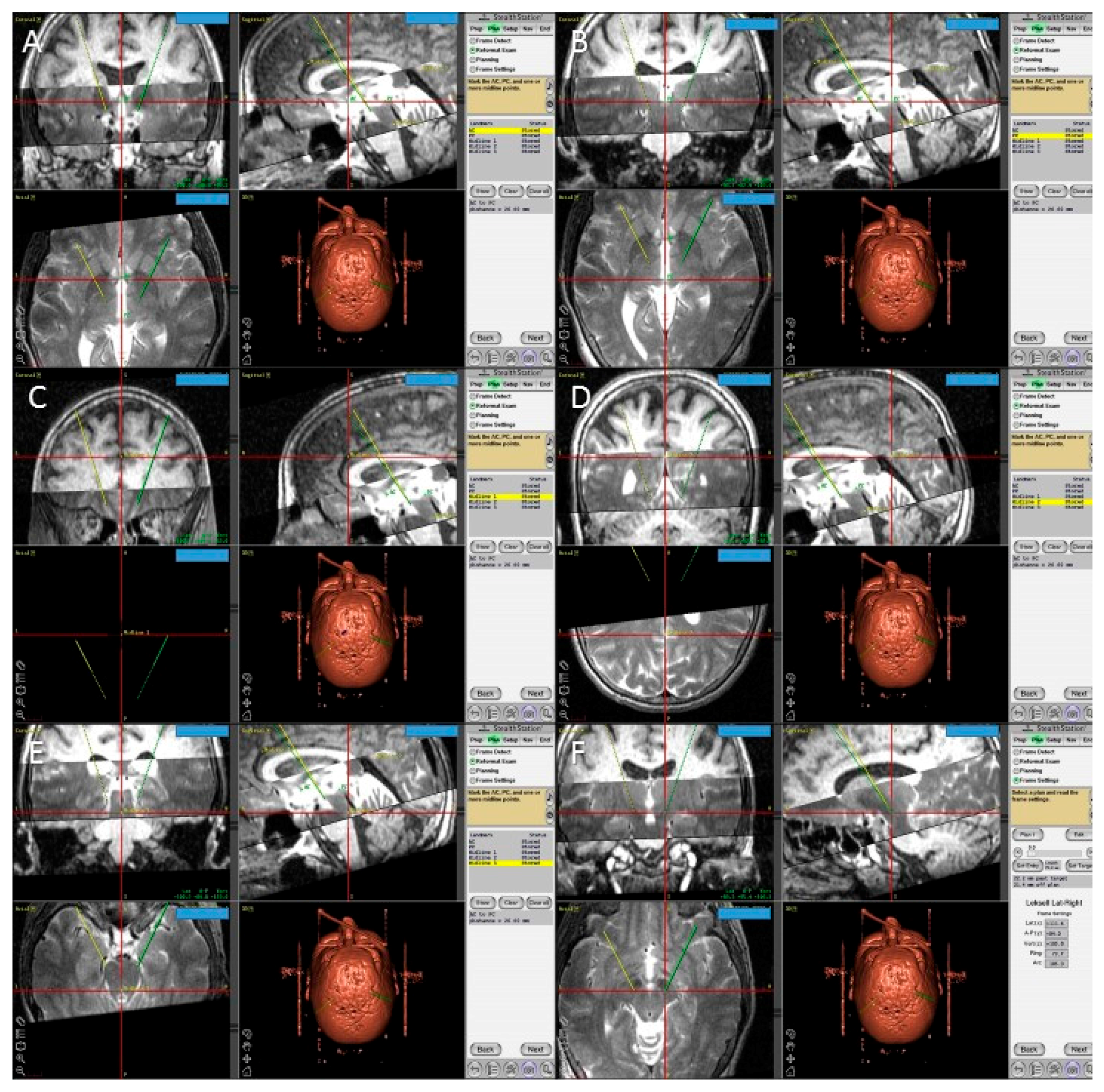 Brainsci 06 00065 g005