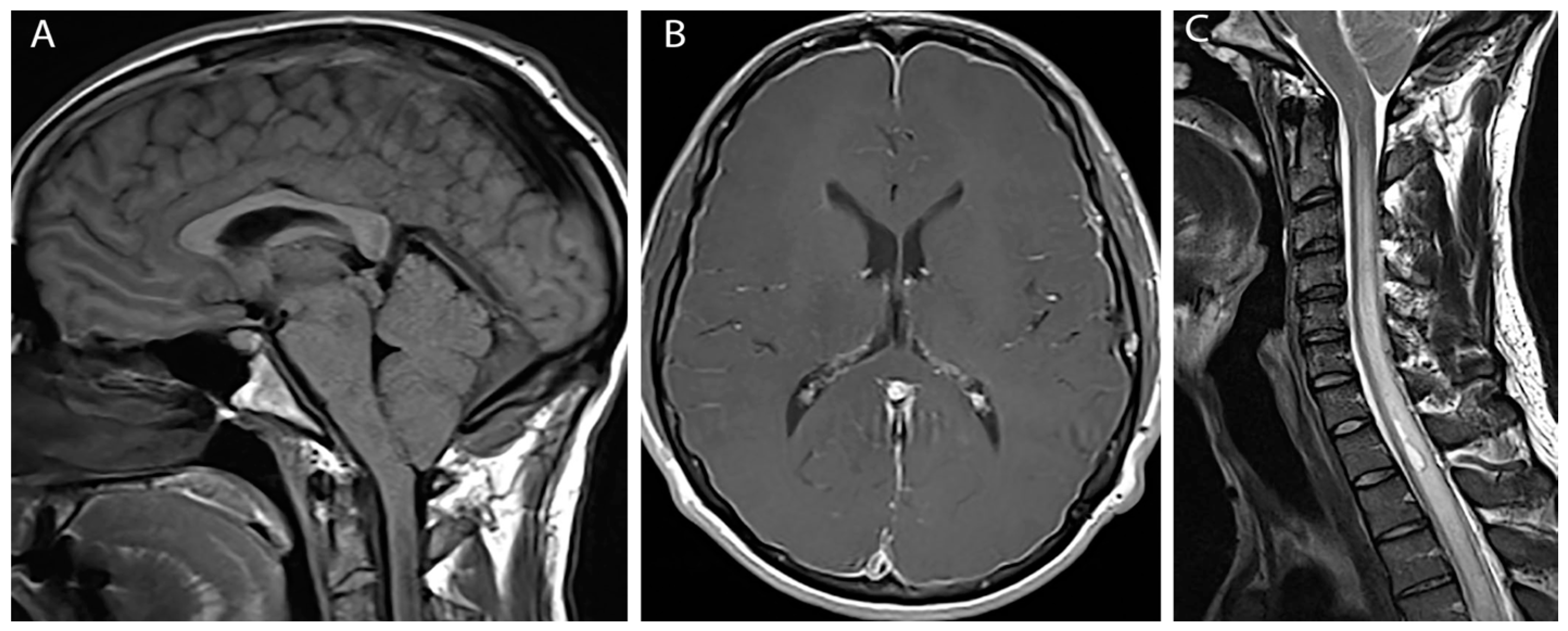 Brainsci 07 00003 g001