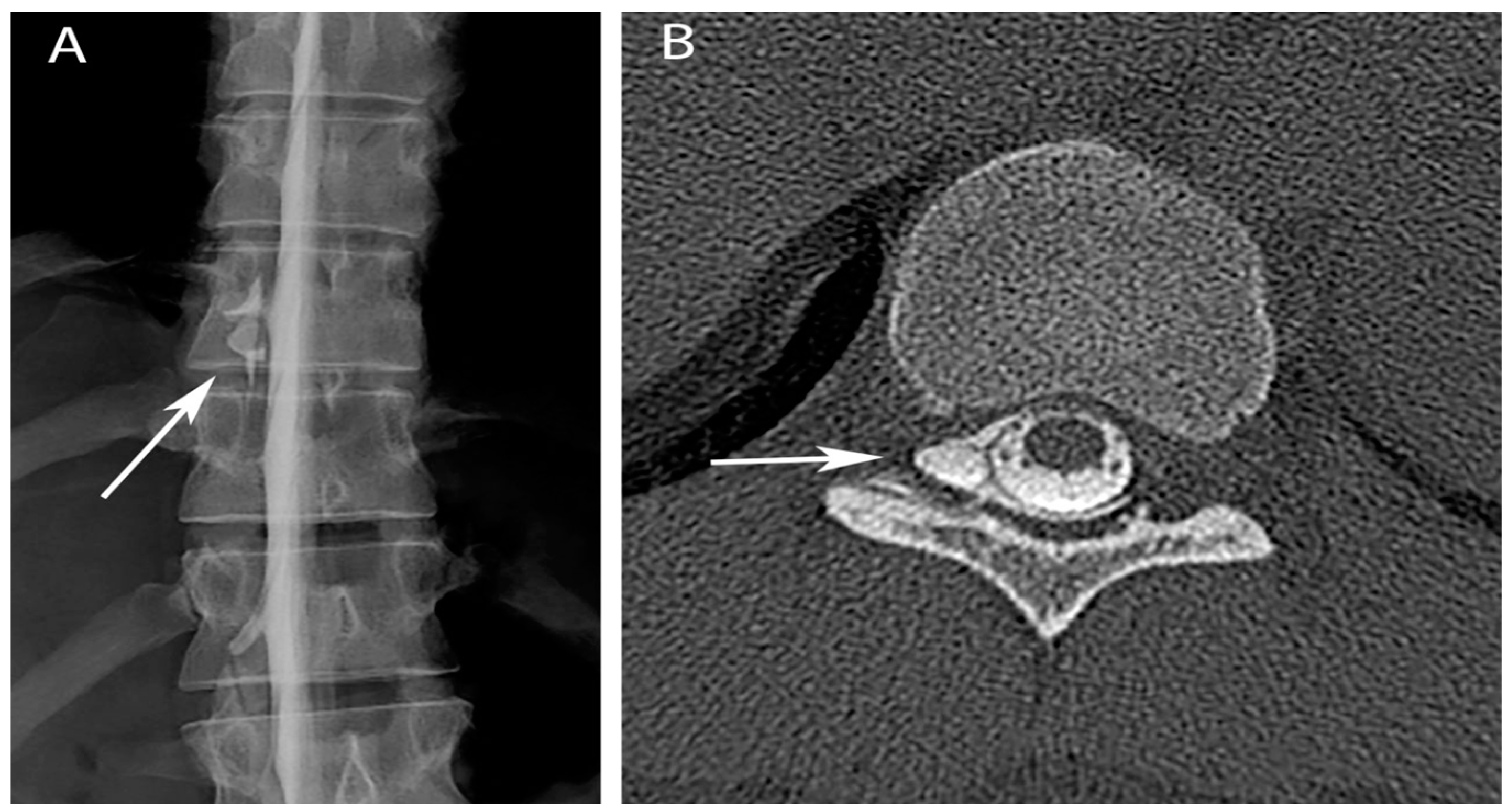 Brainsci 07 00003 g002
