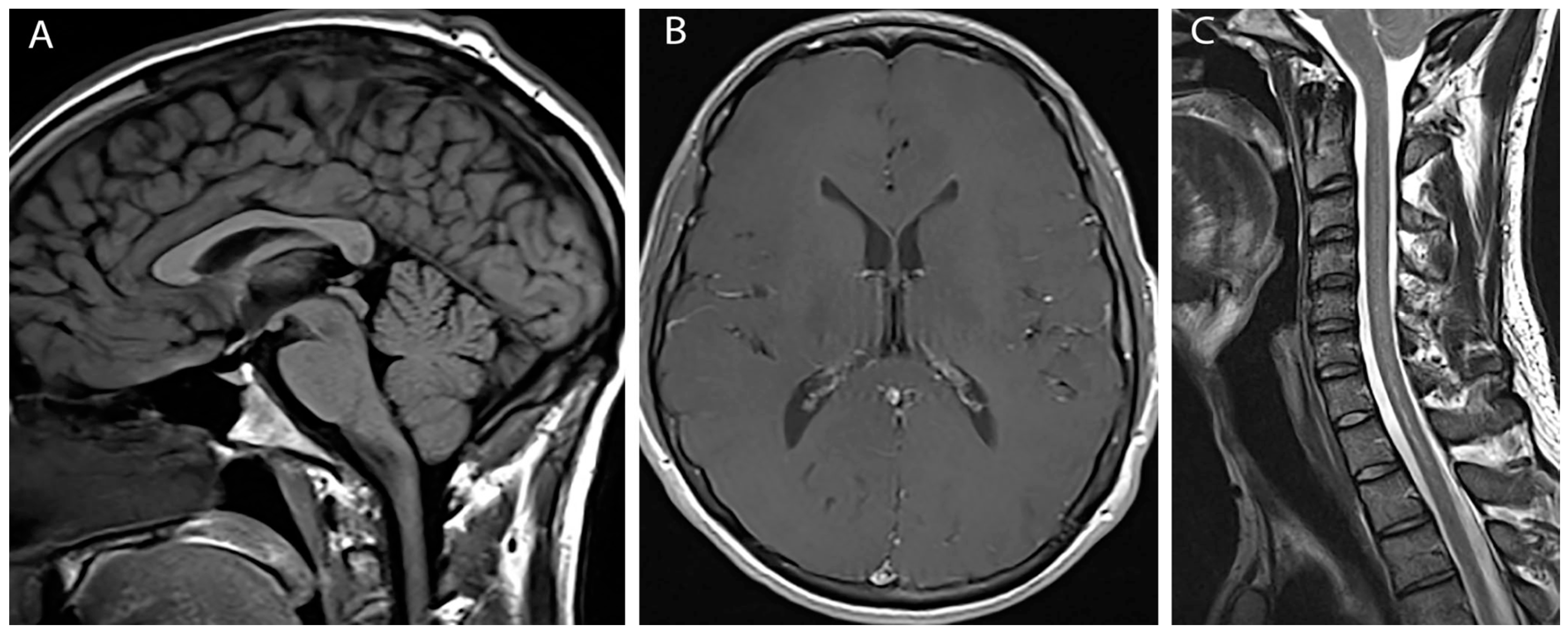 Brainsci 07 00003 g003