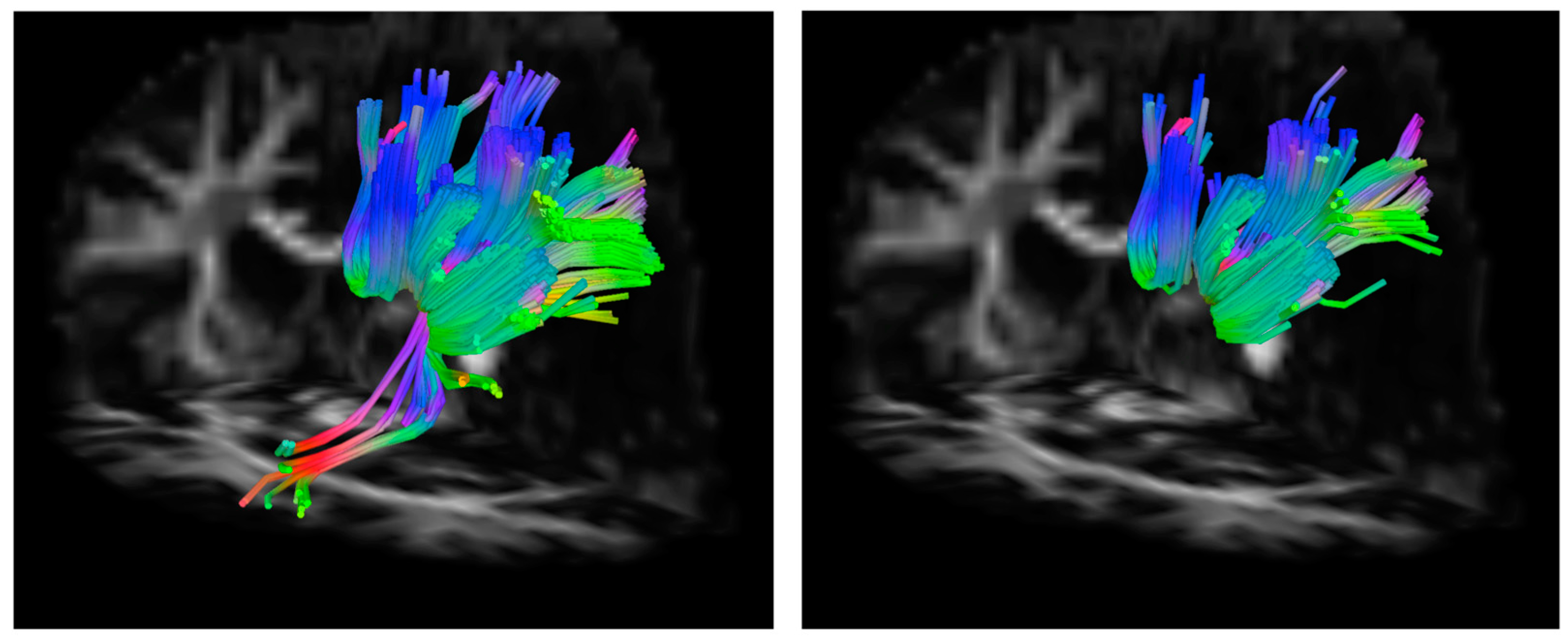 Brainsci 07 00037 g003