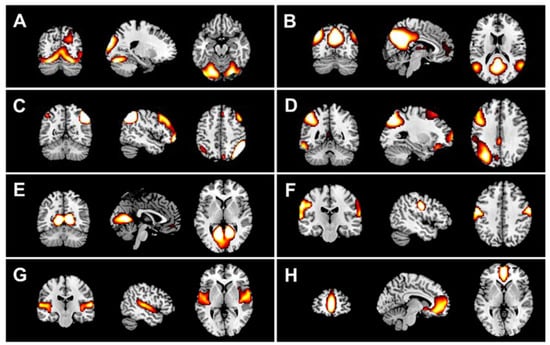 Brainsci 07 00050 g005 550
