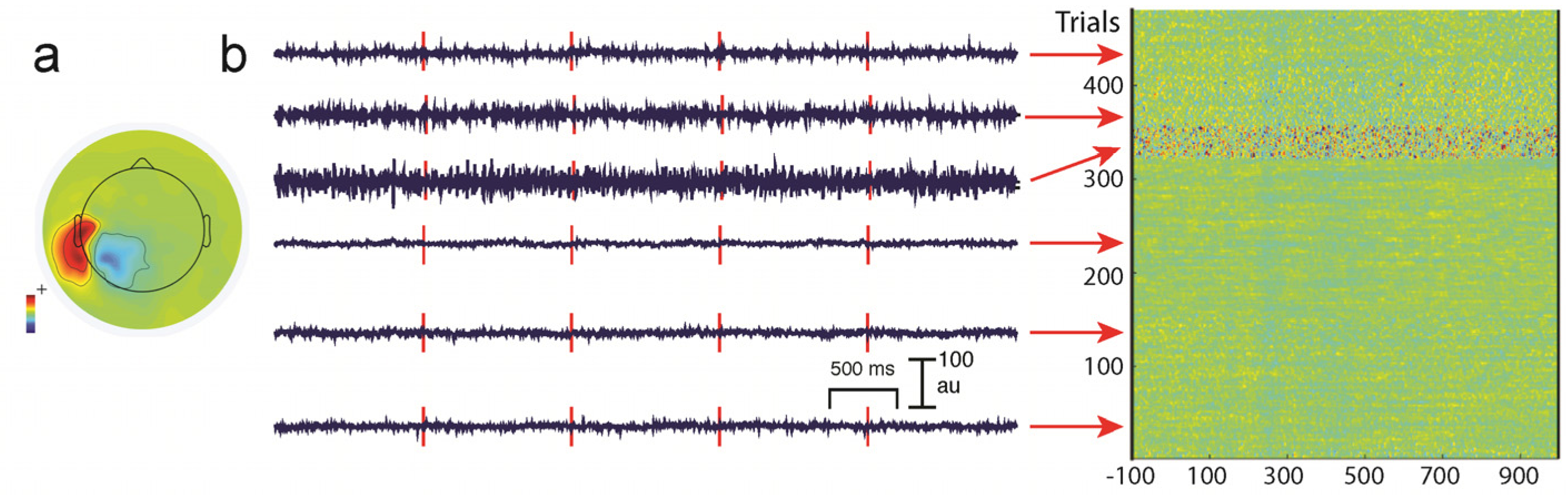 Brainsci 07 00058 g005