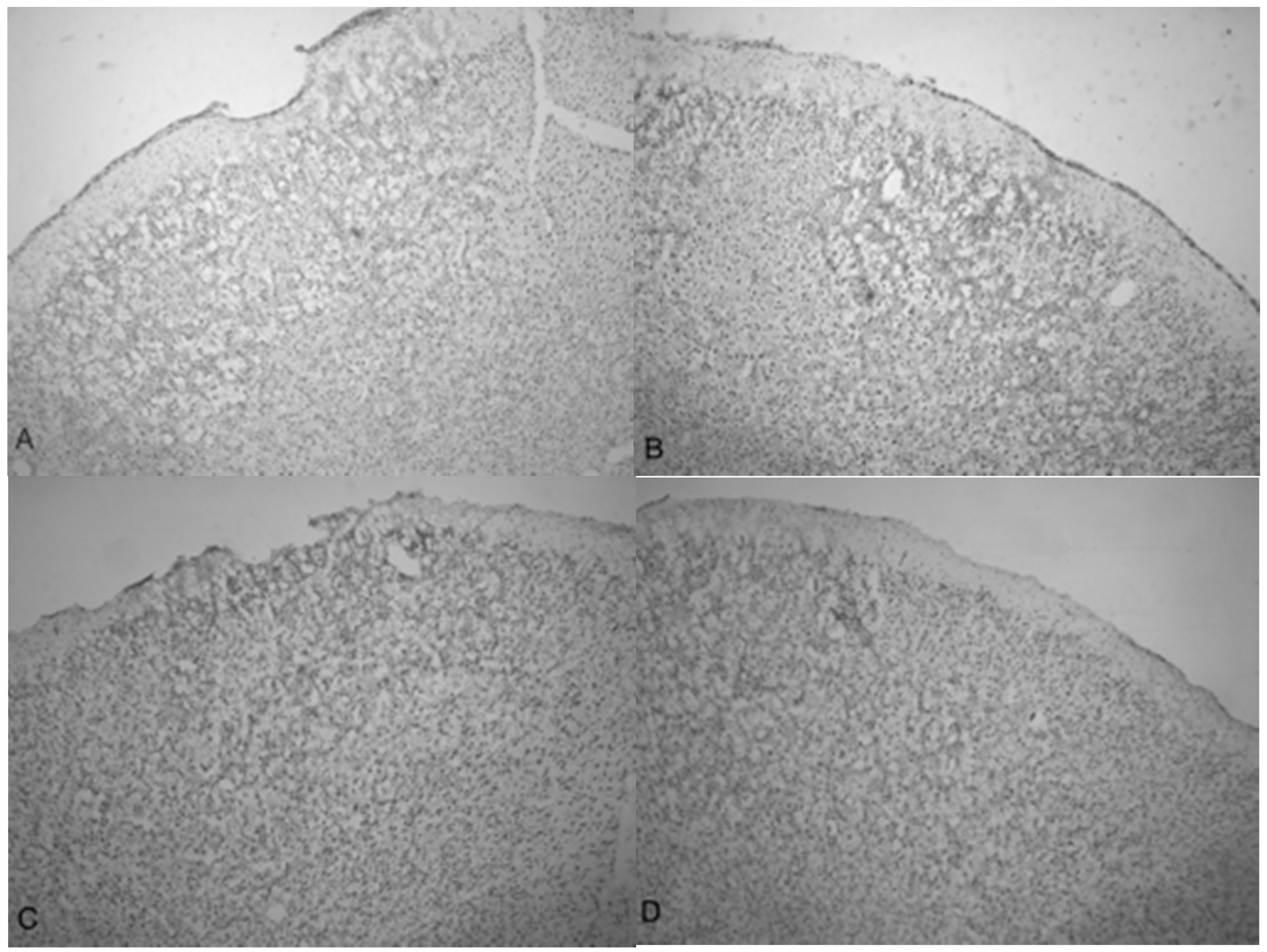Brainsci 07 00059 g004