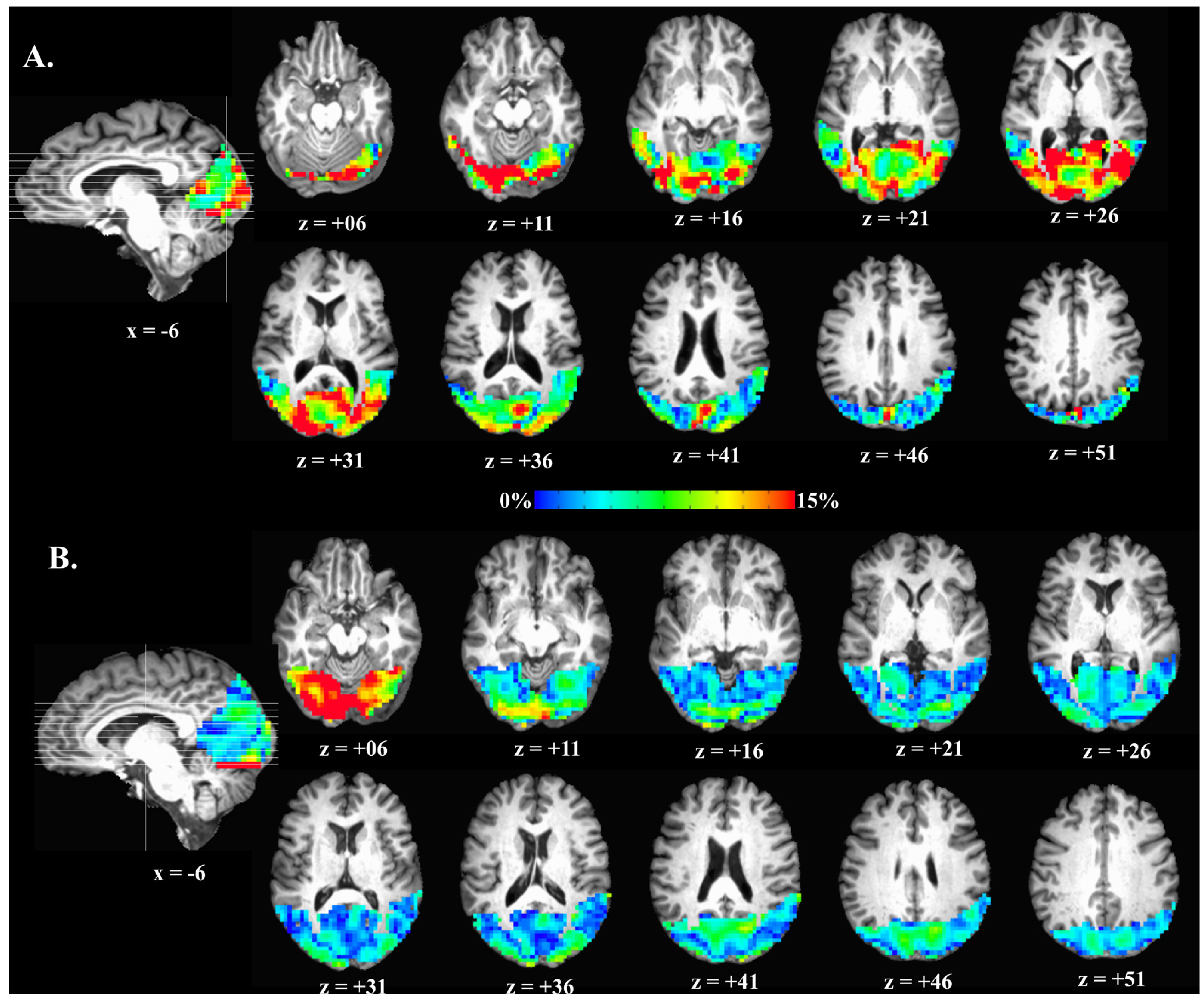 Brainsci 07 00064 g002