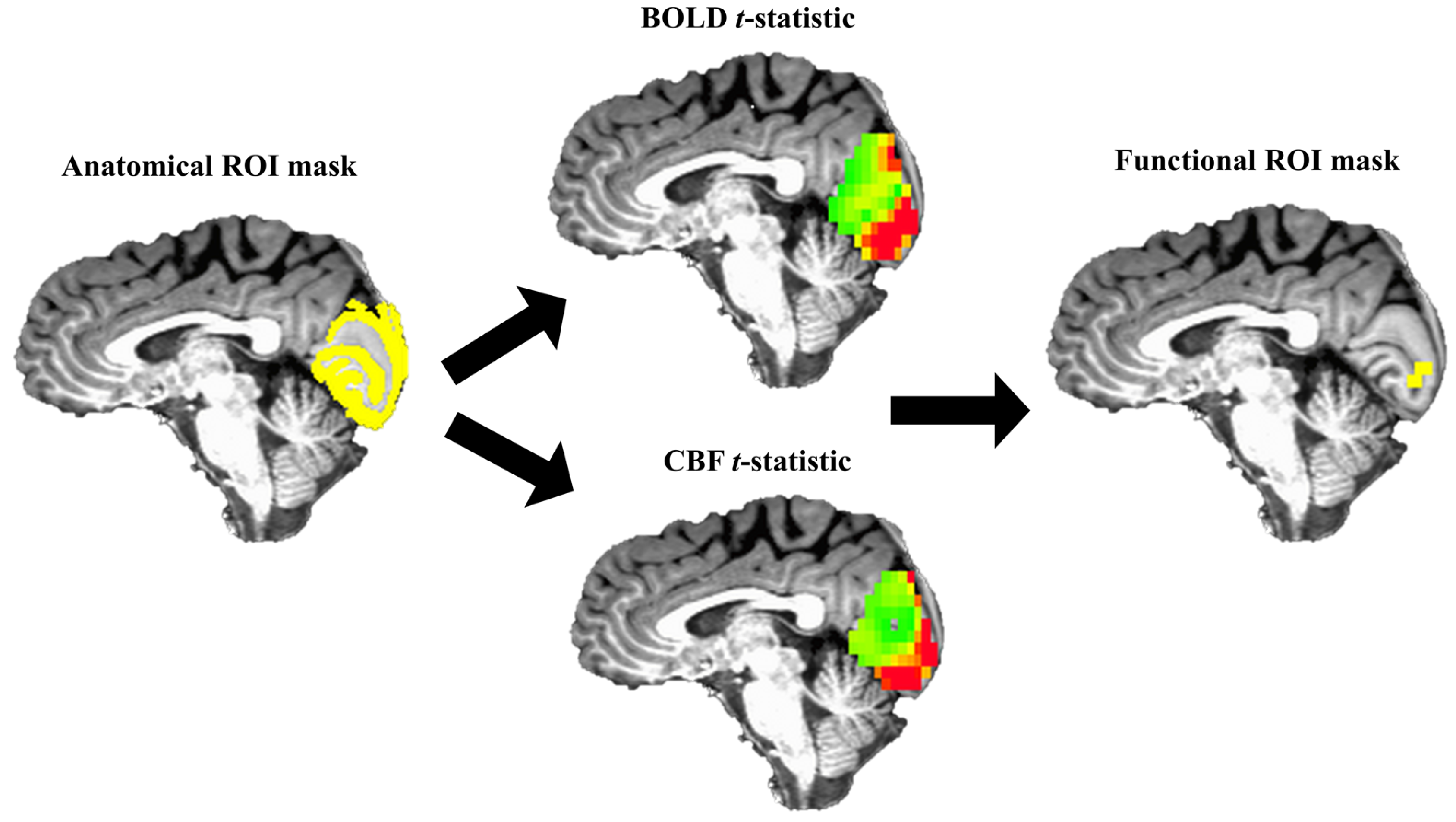 Brainsci 07 00064 g003
