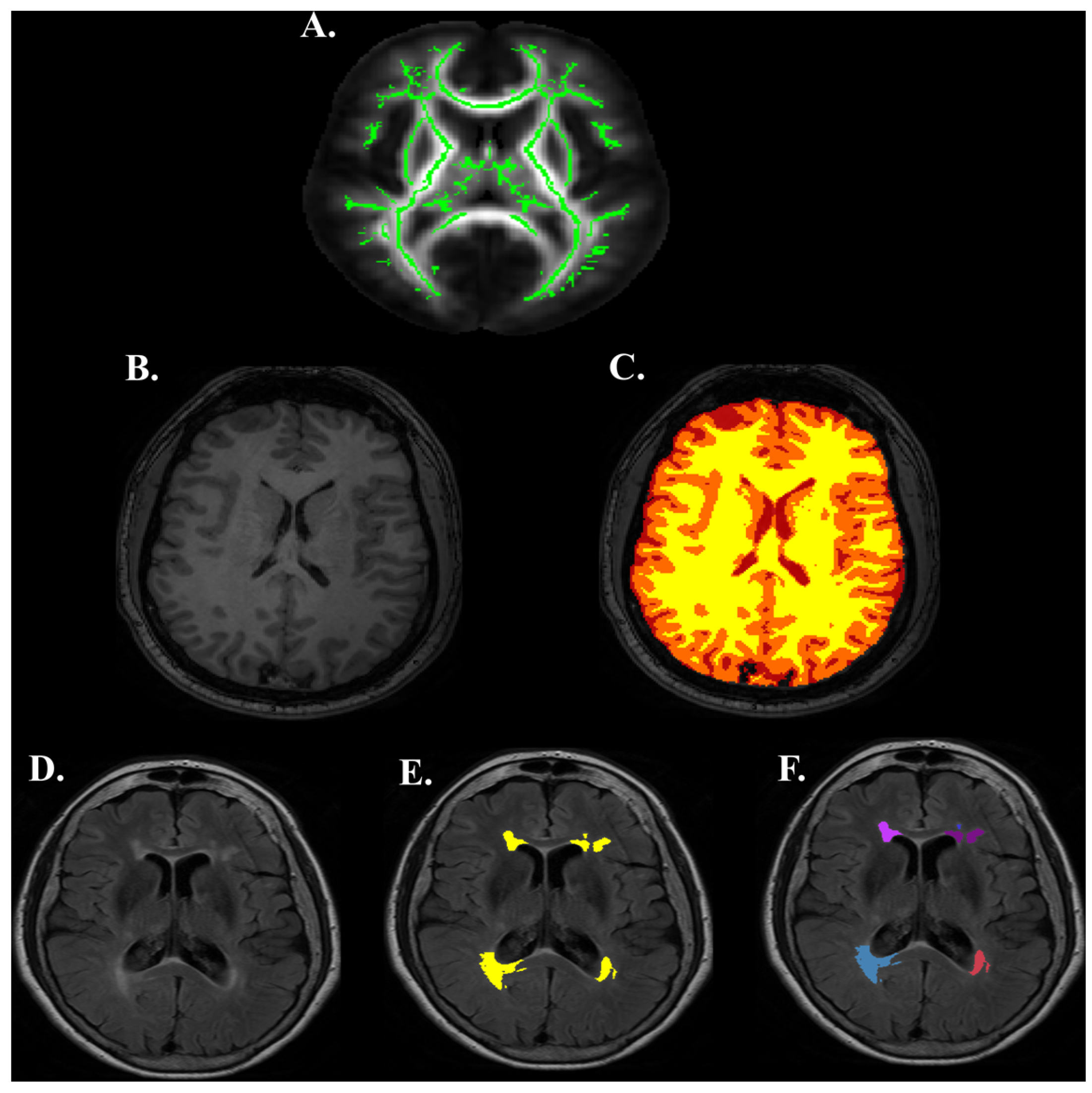 Brainsci 07 00064 g004