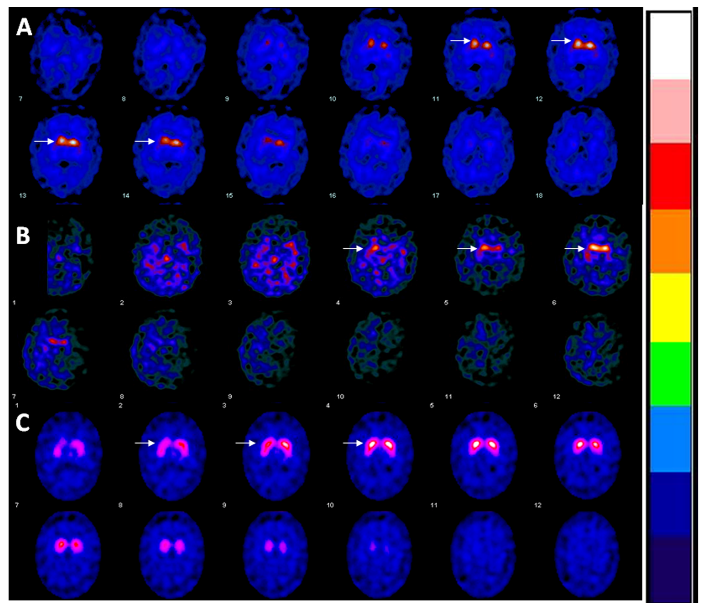 Brainsci 07 00071 g002