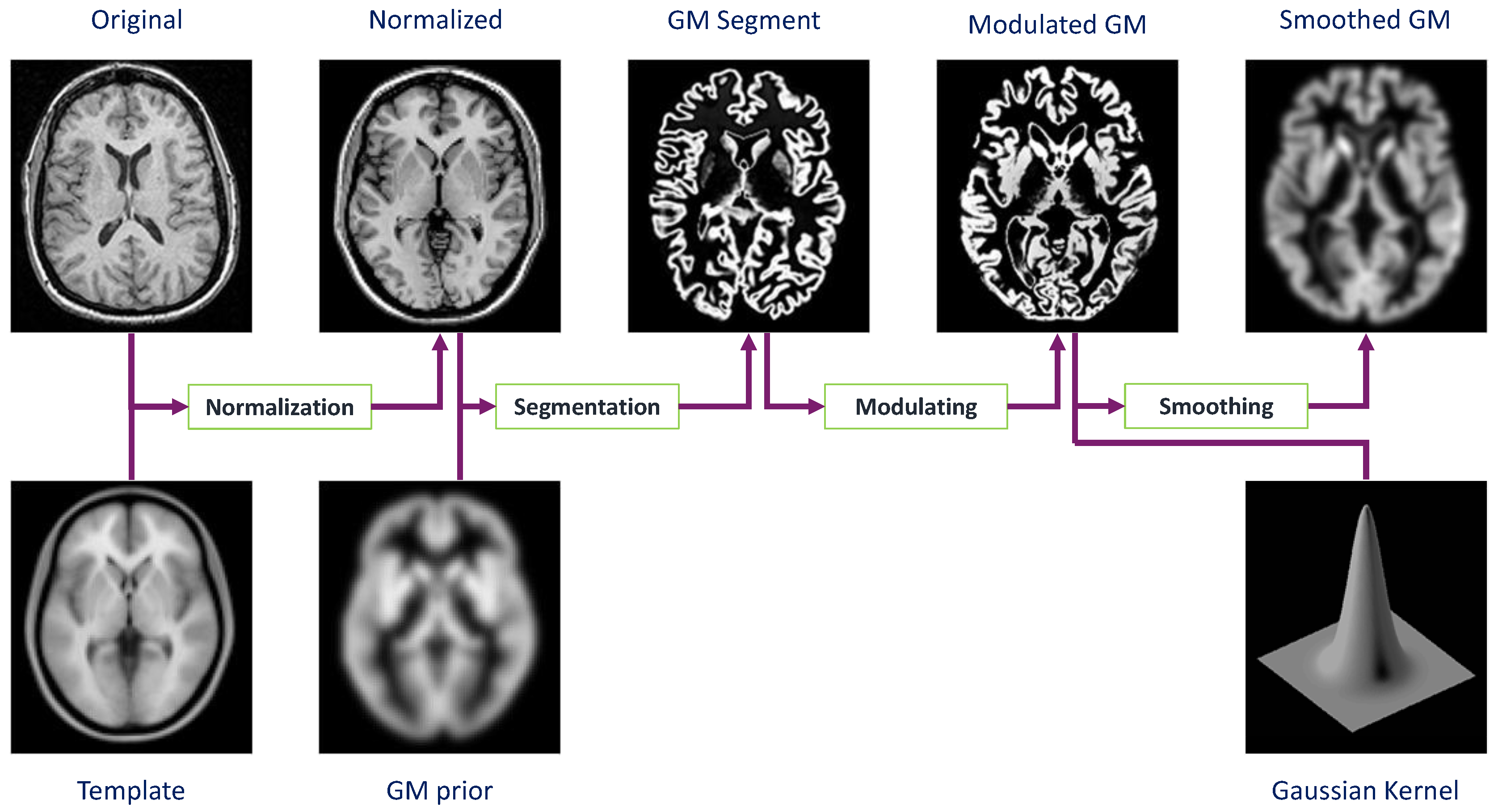 Brainsci 07 00109 g002 Brainsci 07 00109 g002