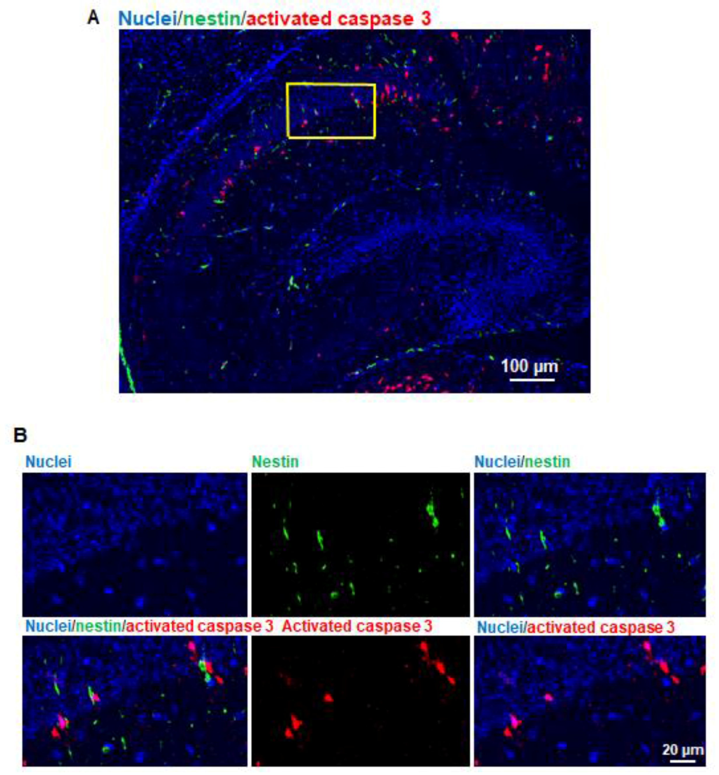 Brainsci 07 00130 g006