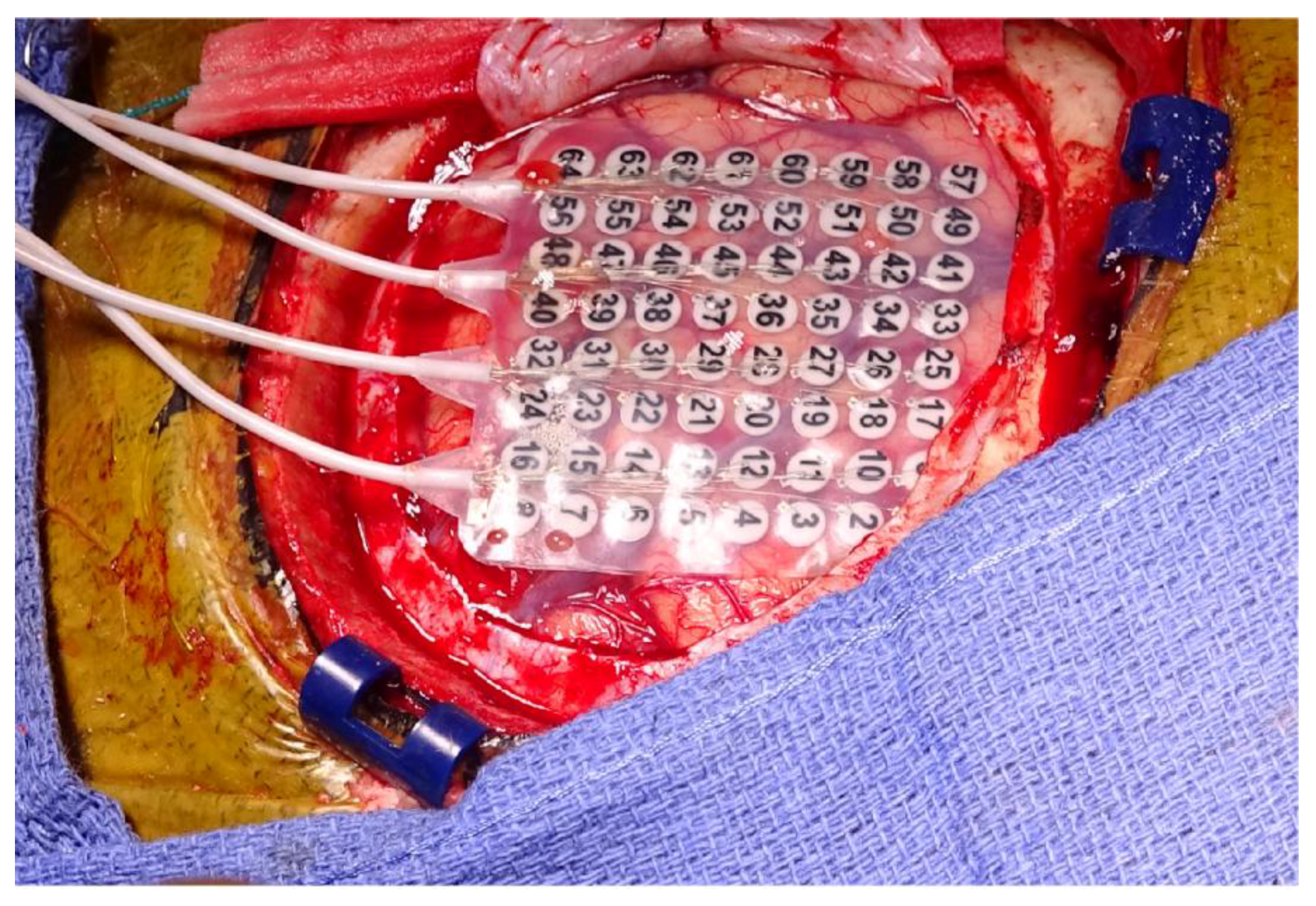 Brainsci 07 00166 g002