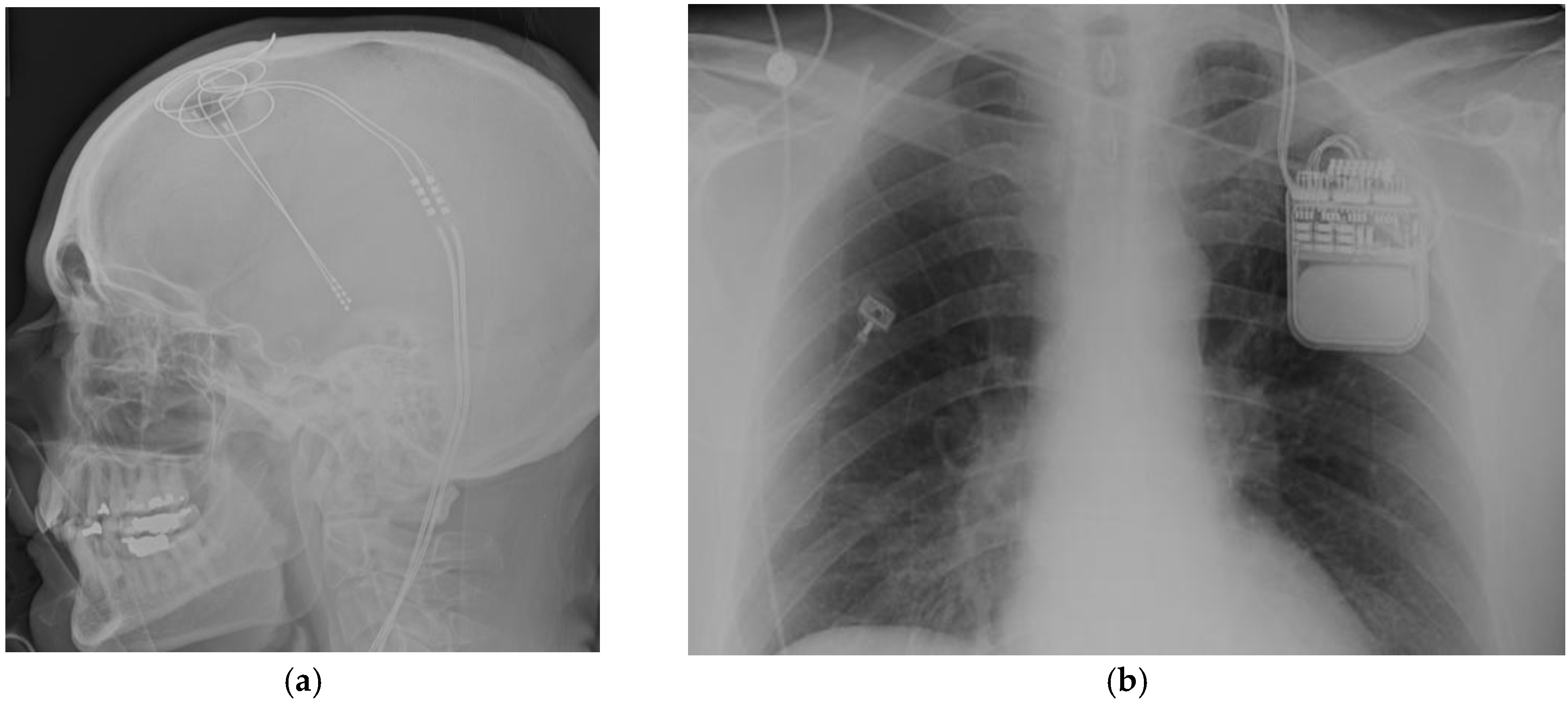 Brainsci 08 00002 g001