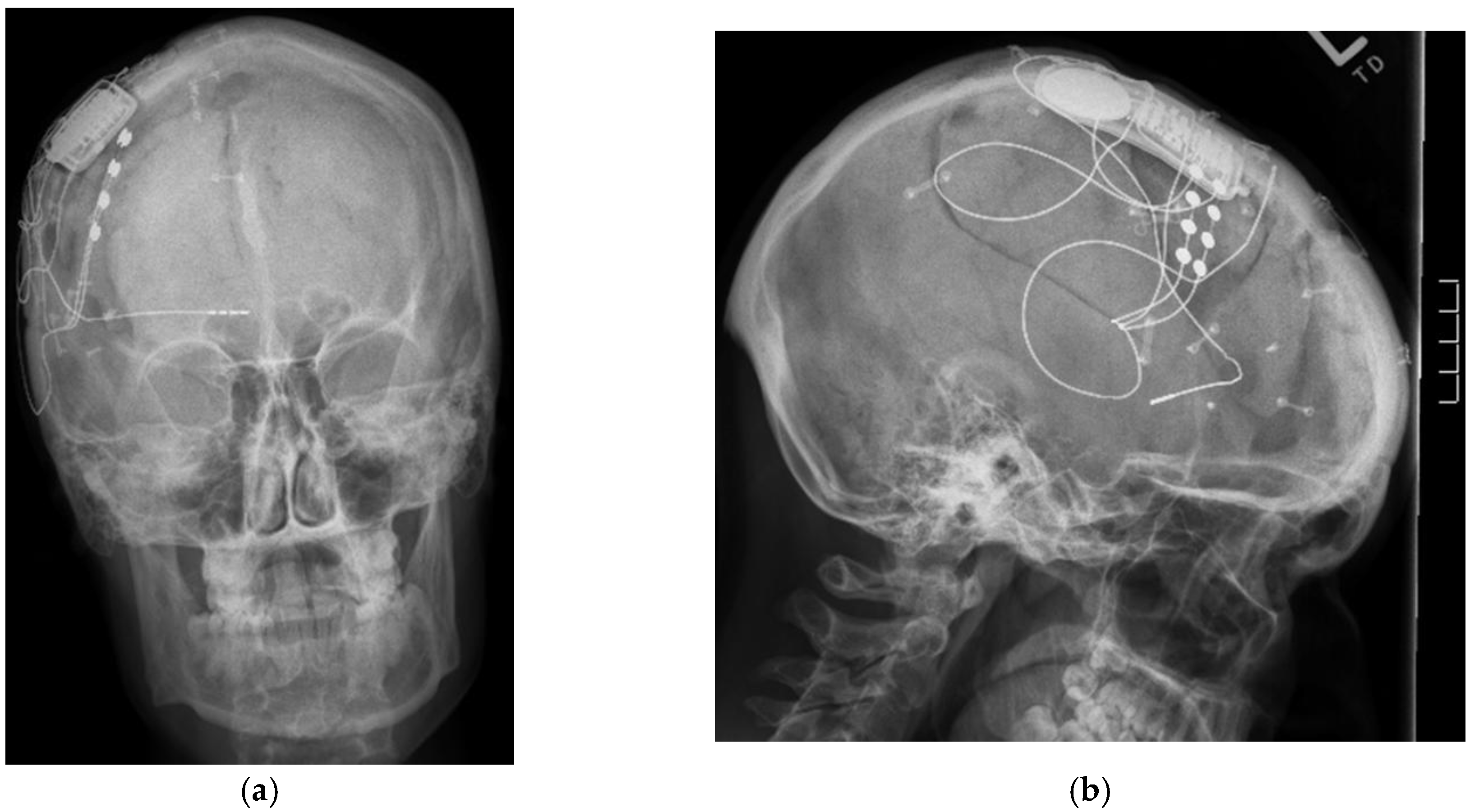 Brainsci 08 00002 g003