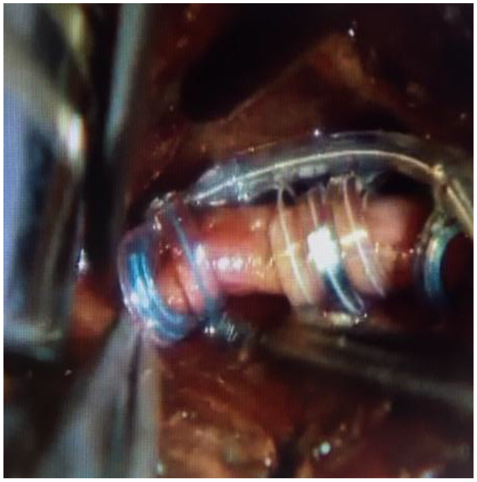 Brainsci 08 00002 g004