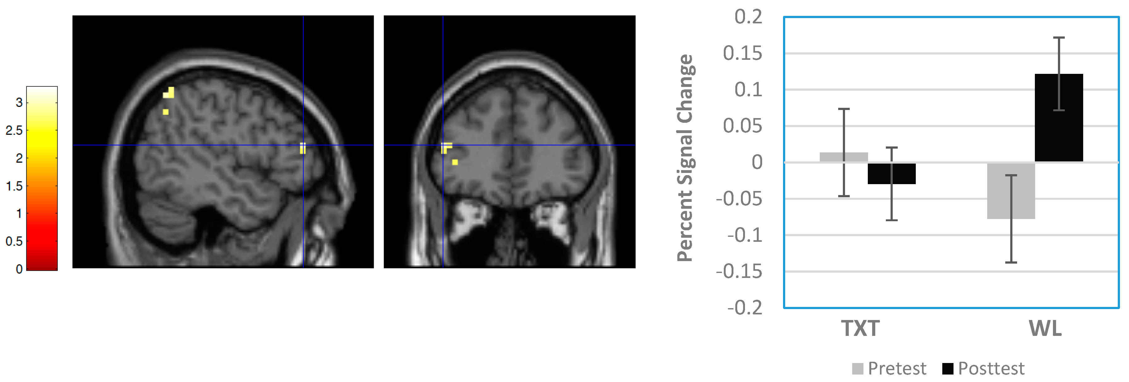 Brainsci 08 00007 g003 Brainsci 08 00007 g003
