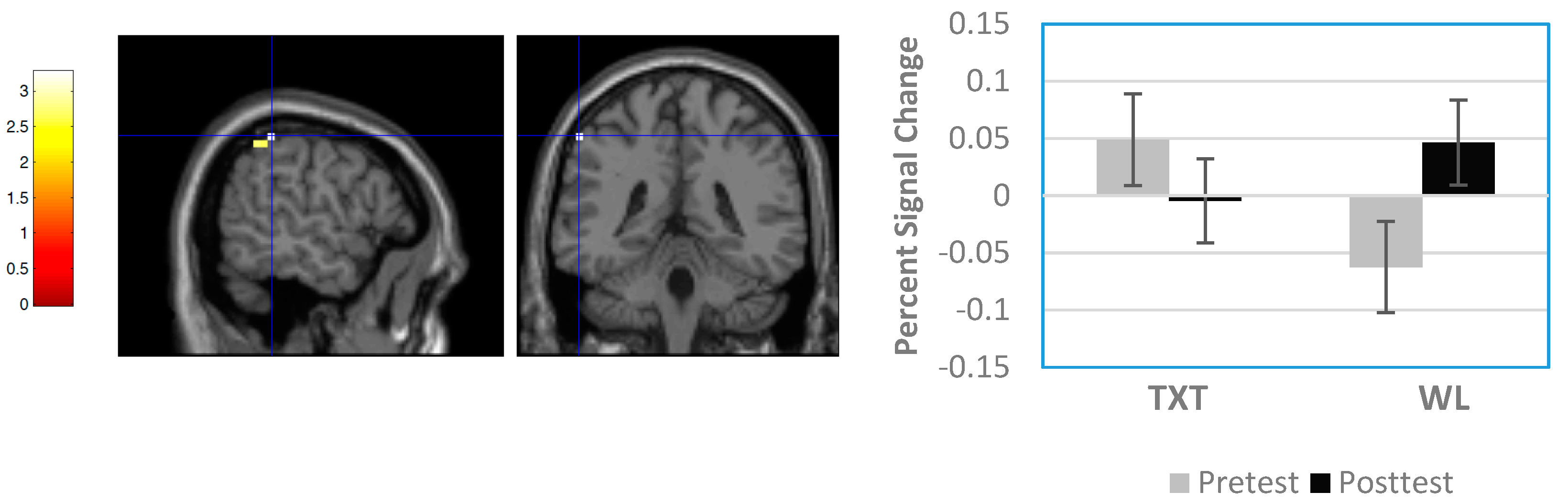 Brainsci 08 00007 g004 Brainsci 08 00007 g004