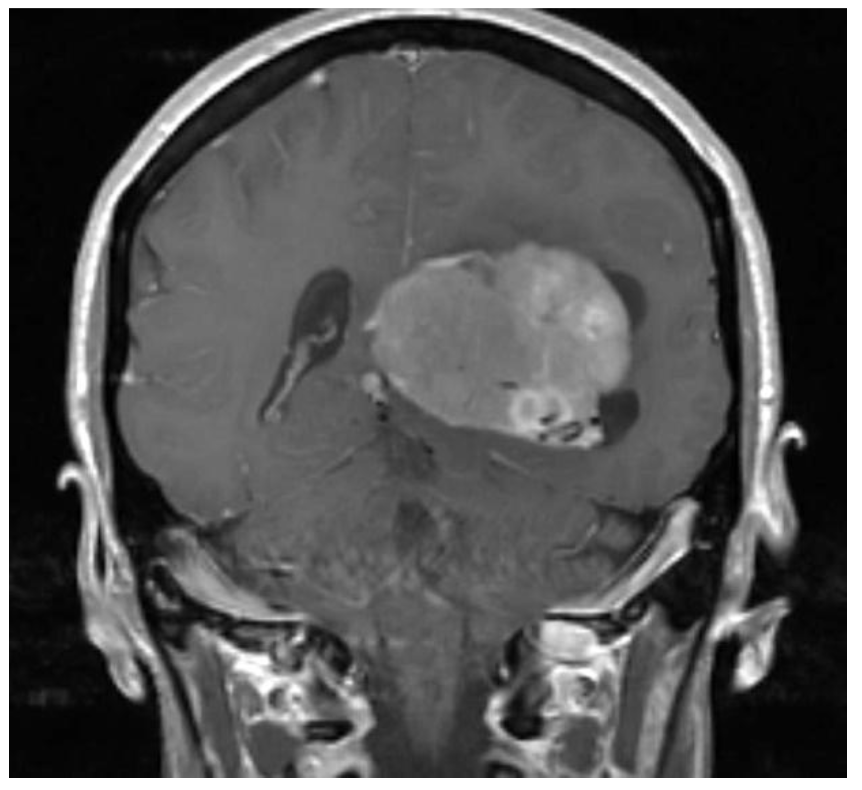 Brainsci 08 00014 g001