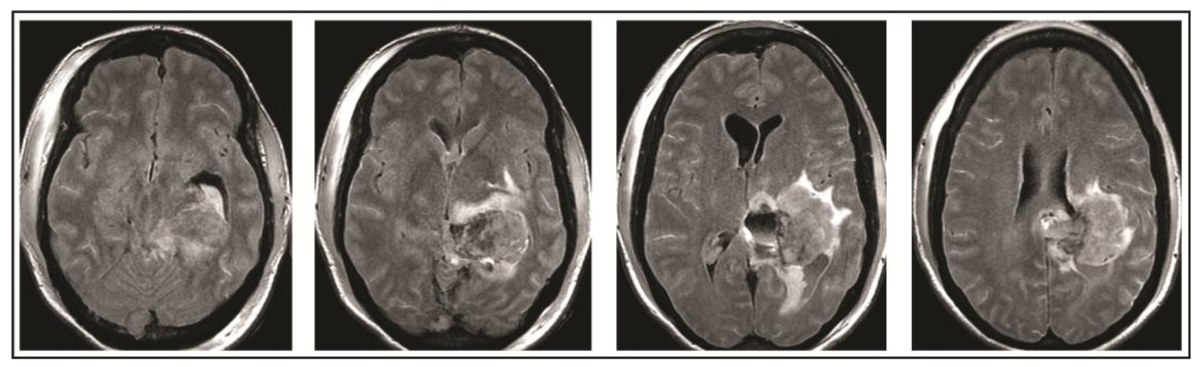Brainsci 08 00014 g002