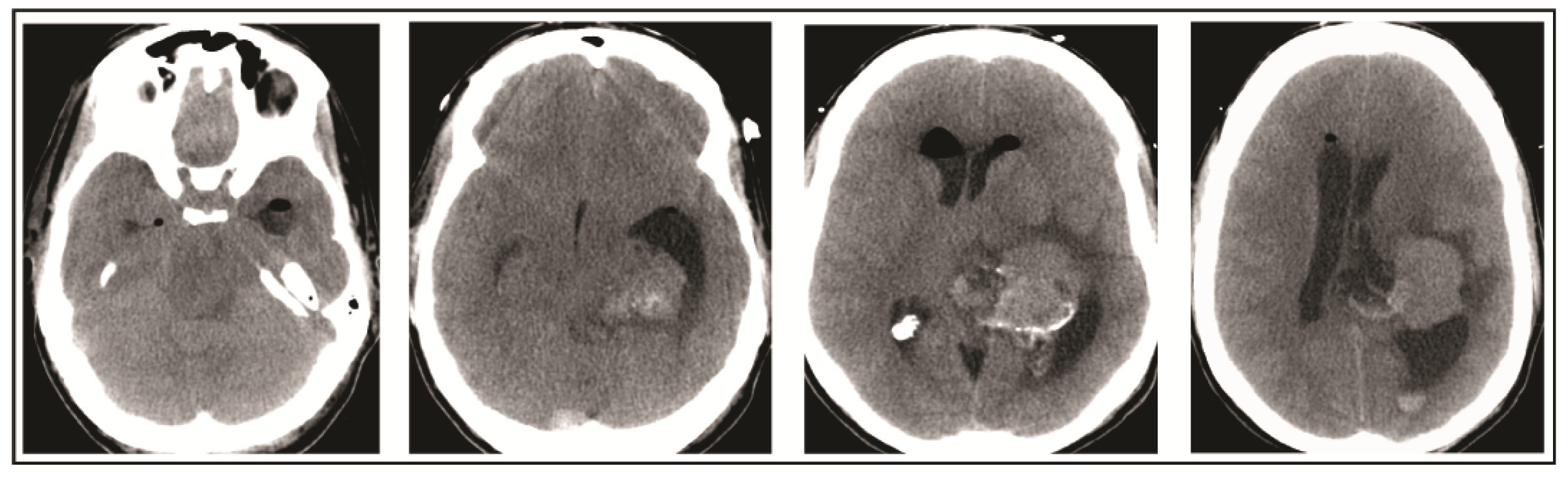 Brainsci 08 00014 g003
