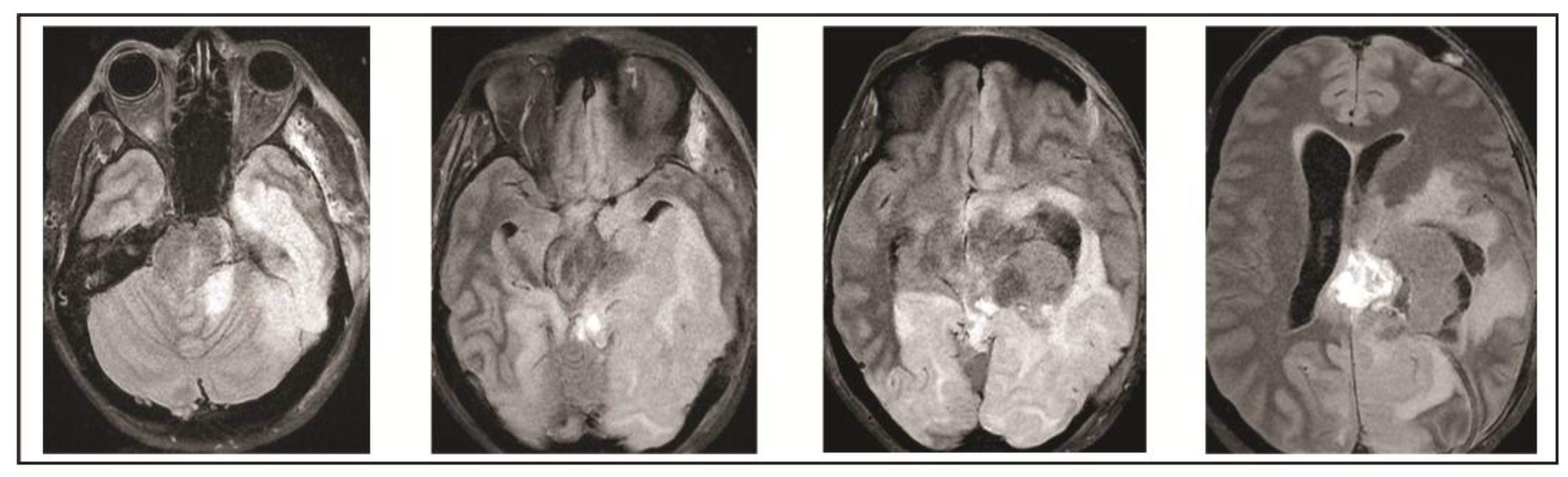 Brainsci 08 00014 g006