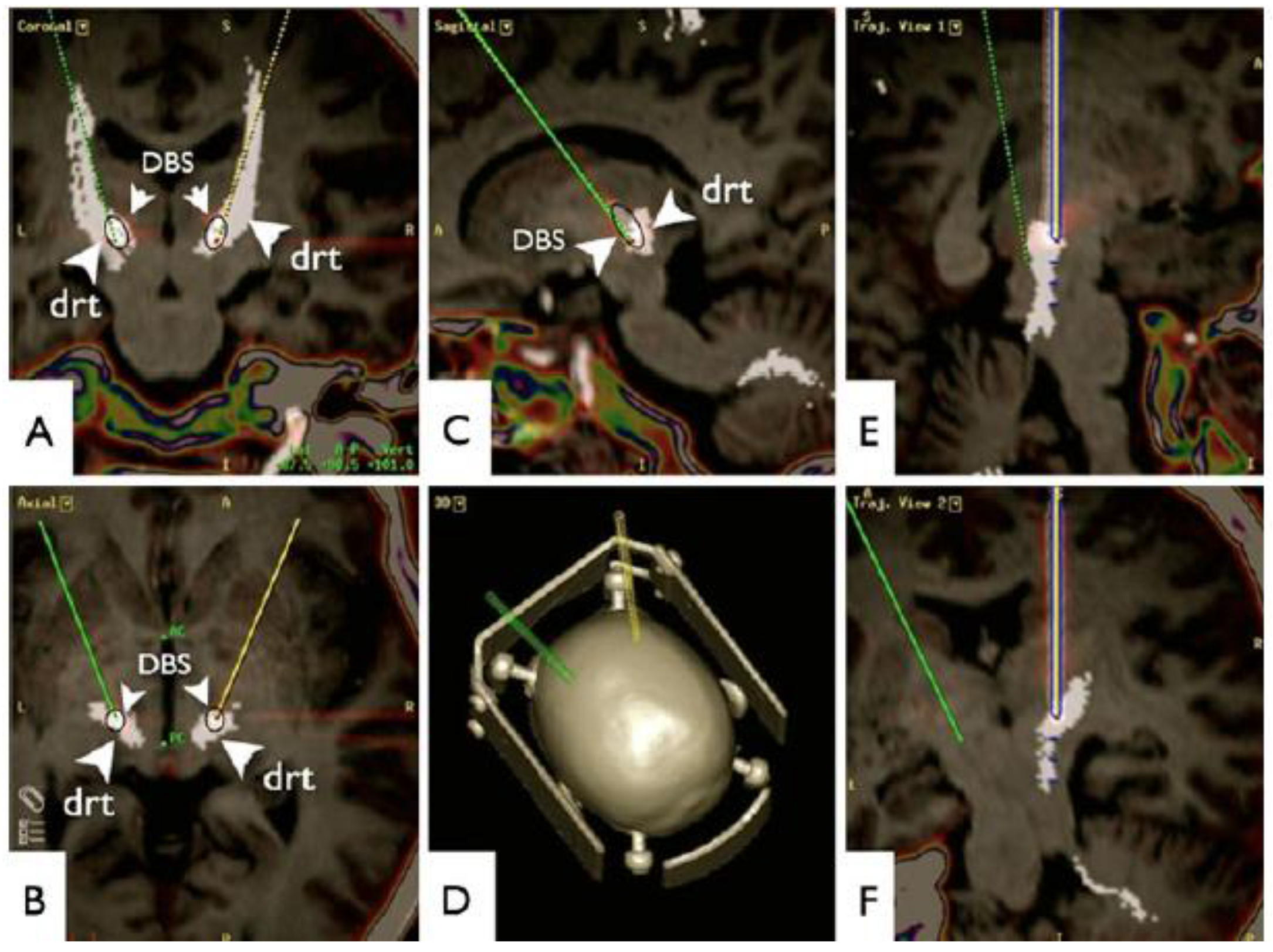 Brainsci 08 00023 g003