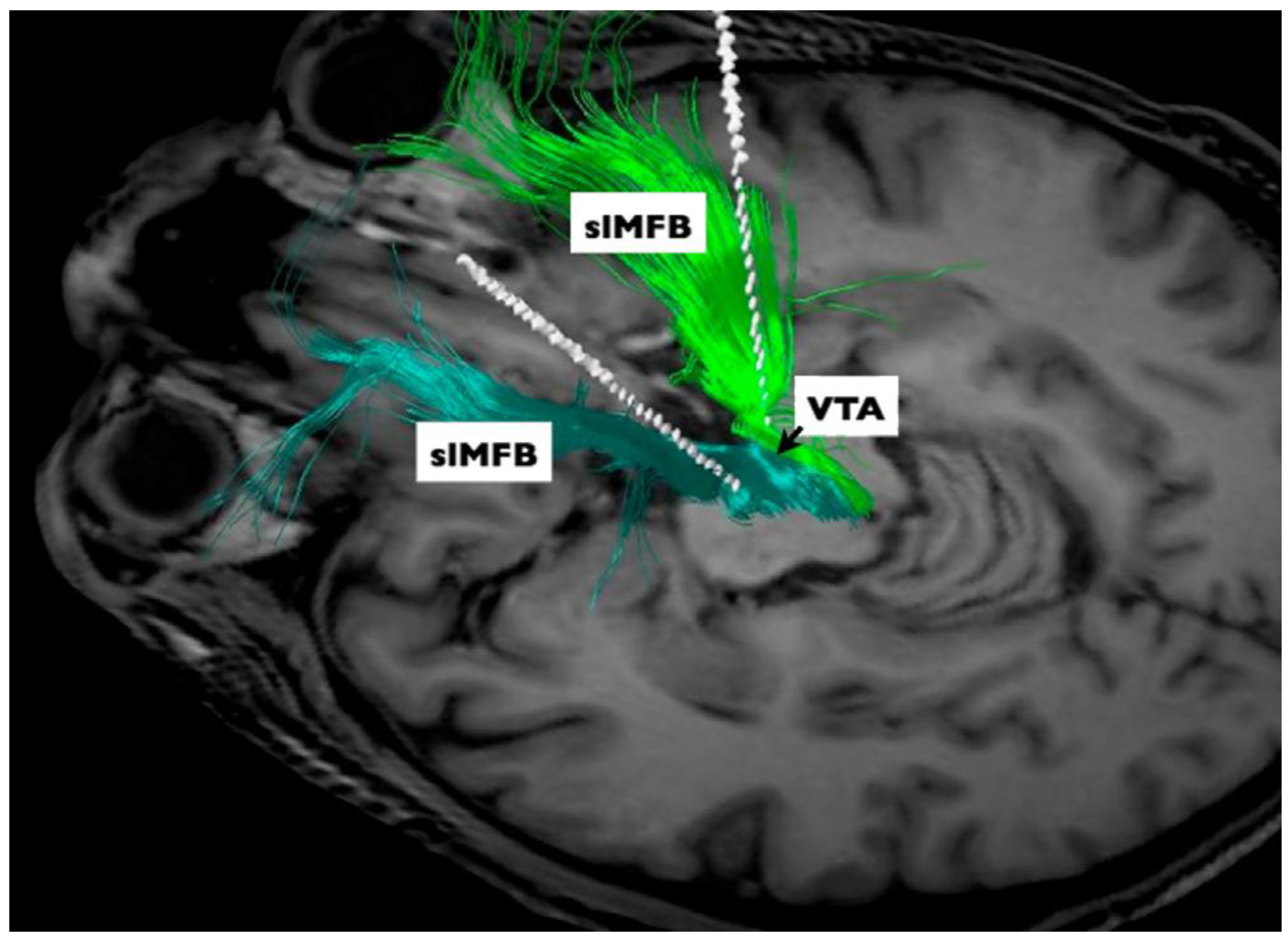 Brainsci 08 00023 g004