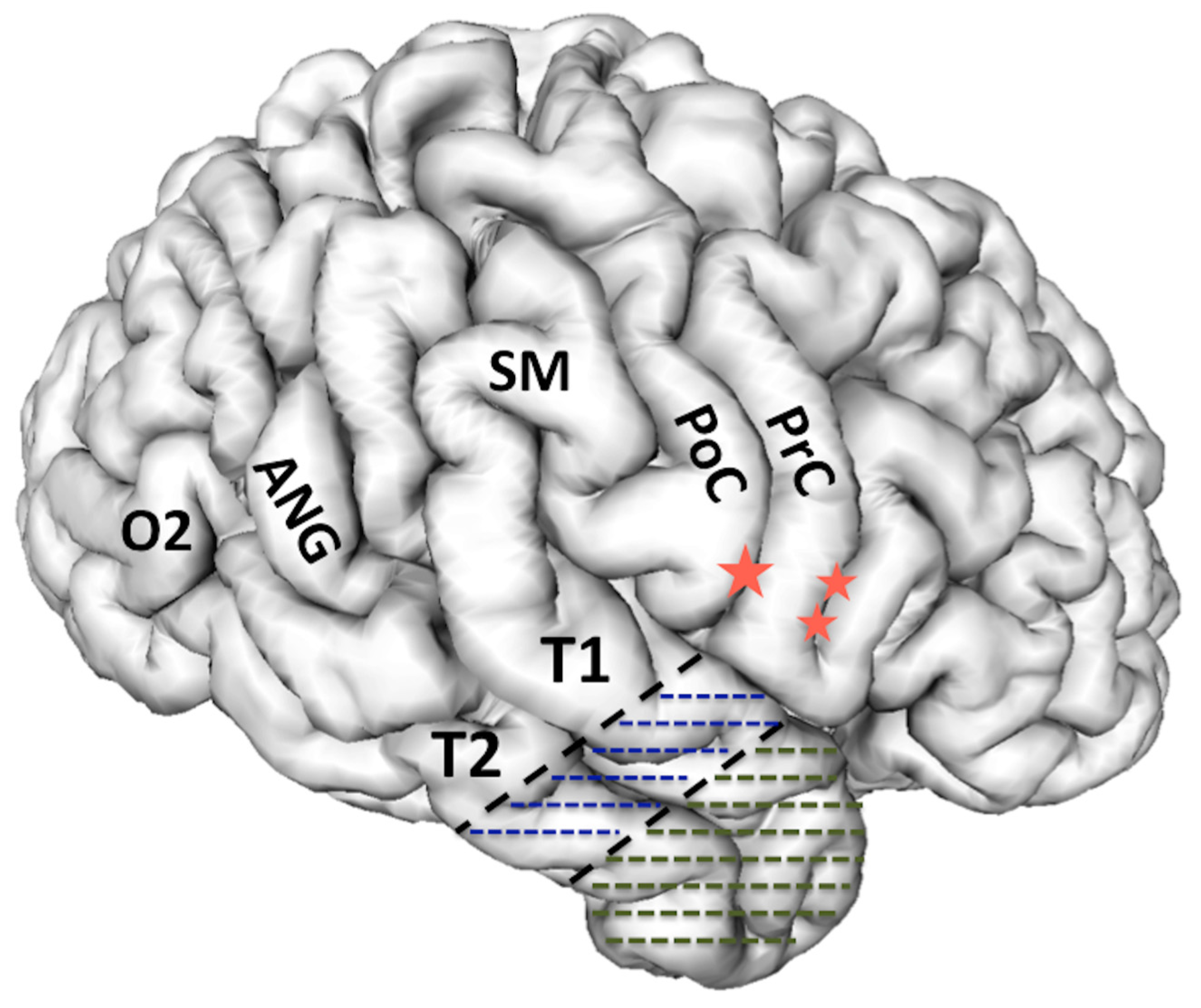 Brainsci 08 00035 g001 Brainsci 08 00035 g001