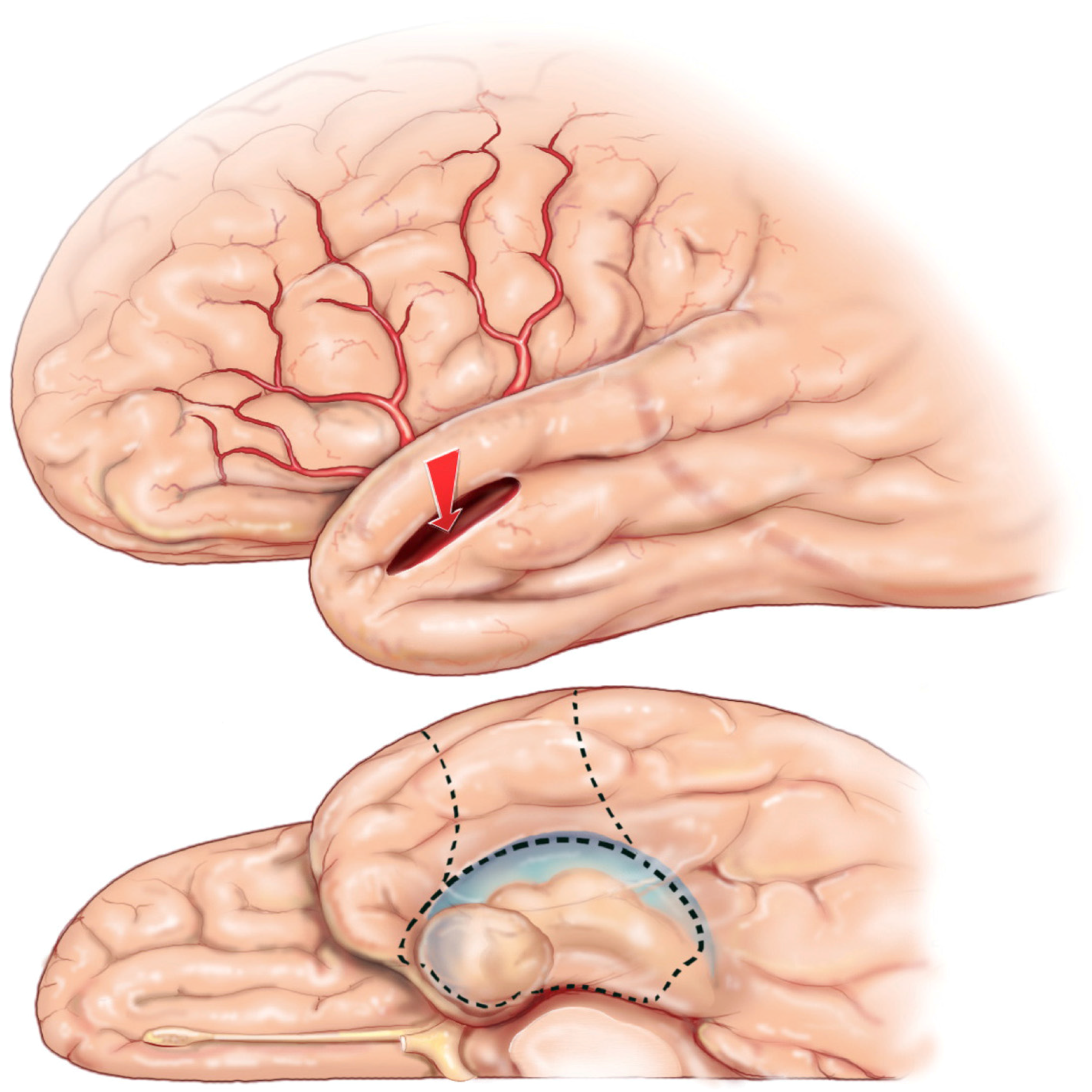 Brainsci 08 00035 g005 Brainsci 08 00035 g005