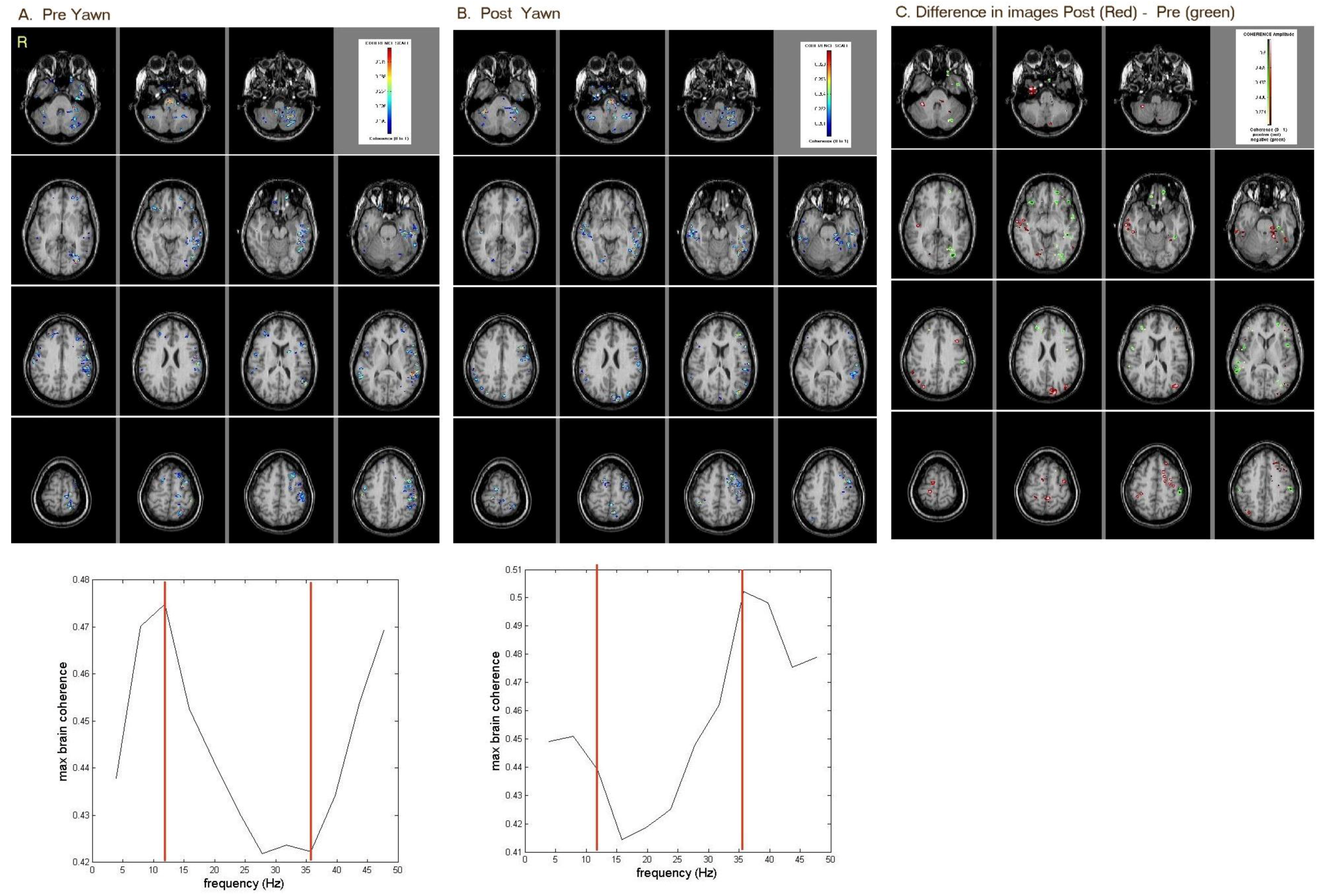 Brainsci 08 00051 g001