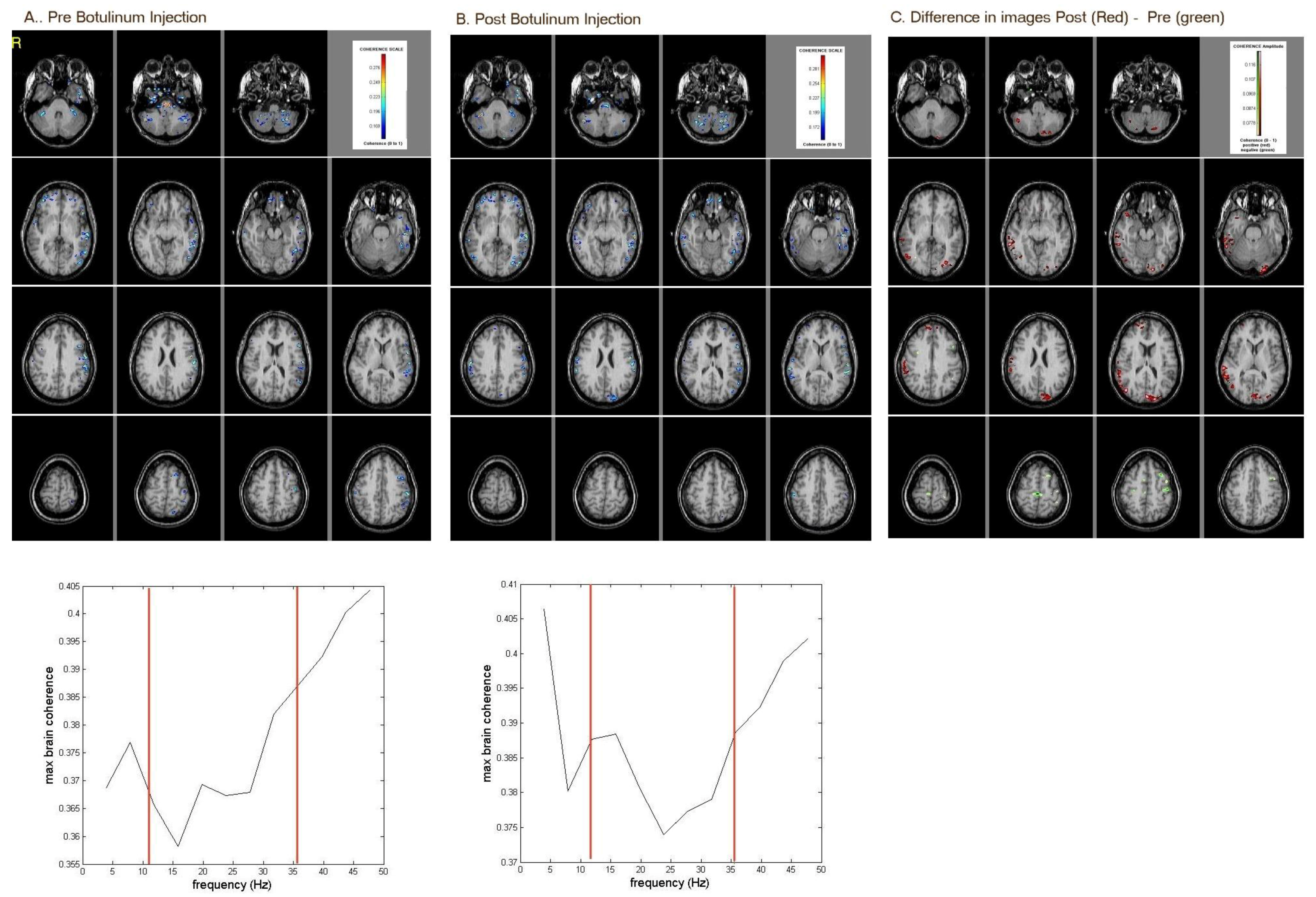 Brainsci 08 00051 g002