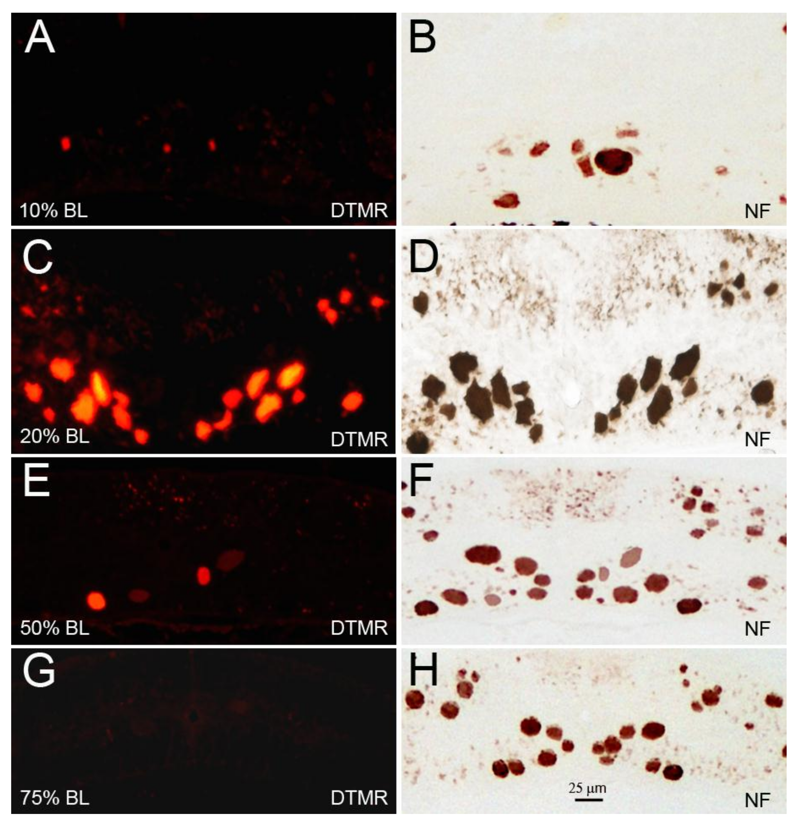 Brainsci 08 00065 g008