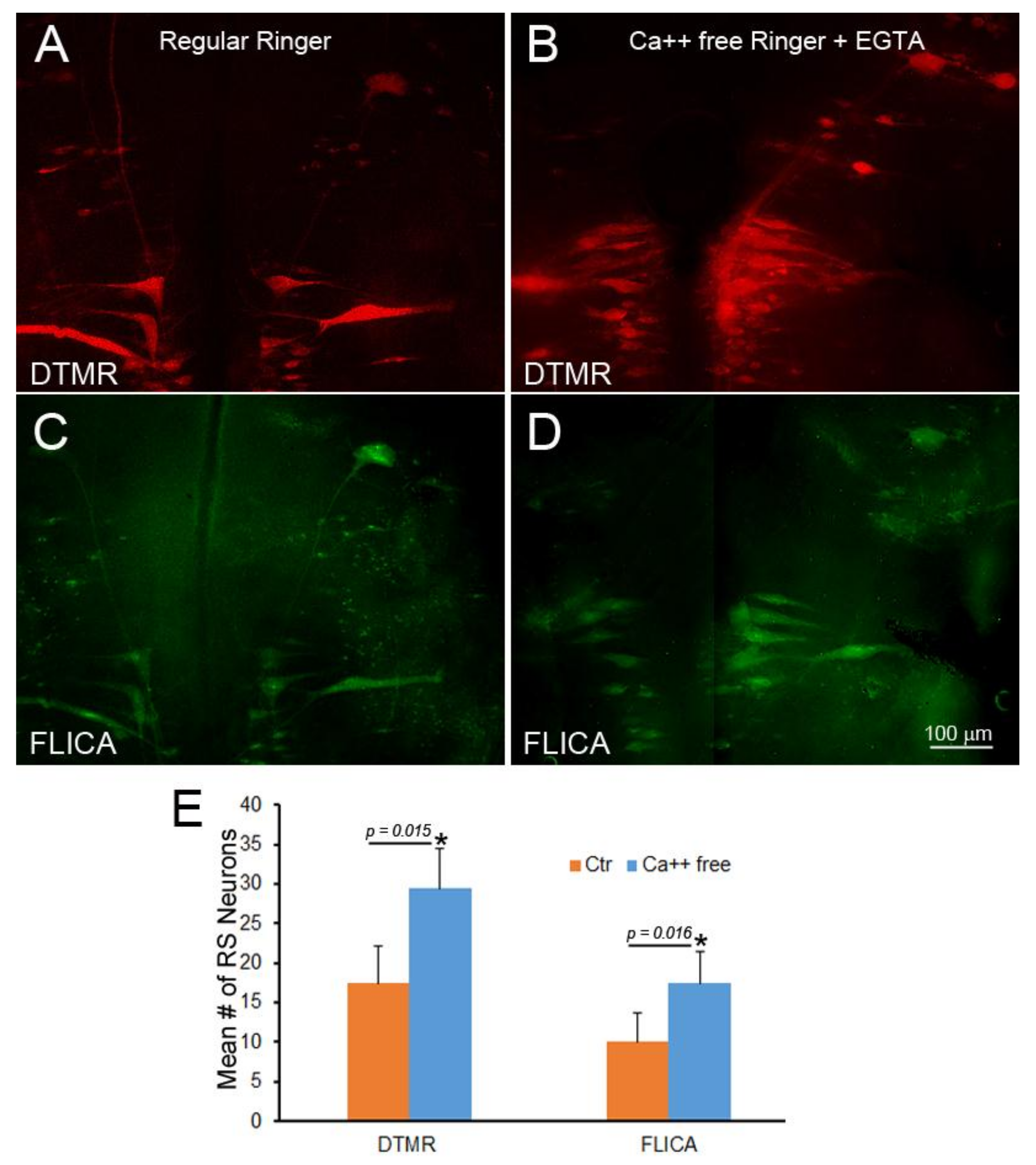 Brainsci 08 00065 g011