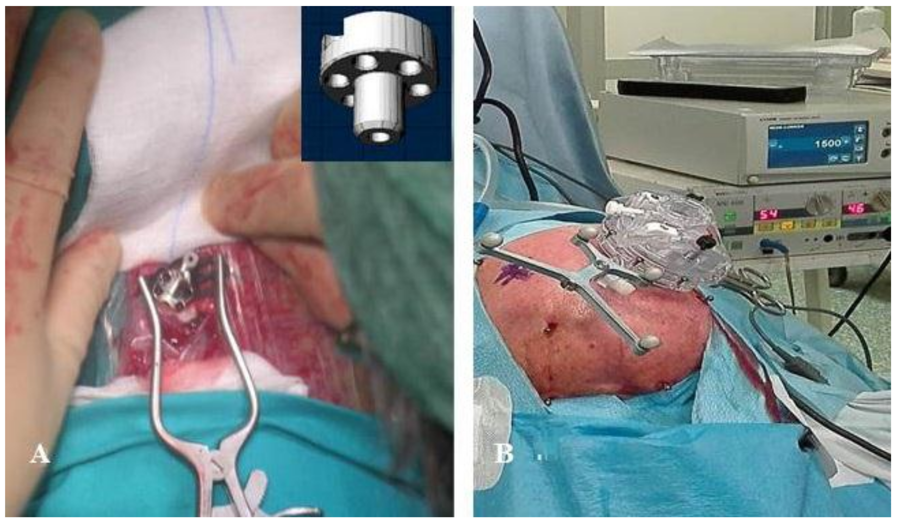 Brainsci 08 00090 g001