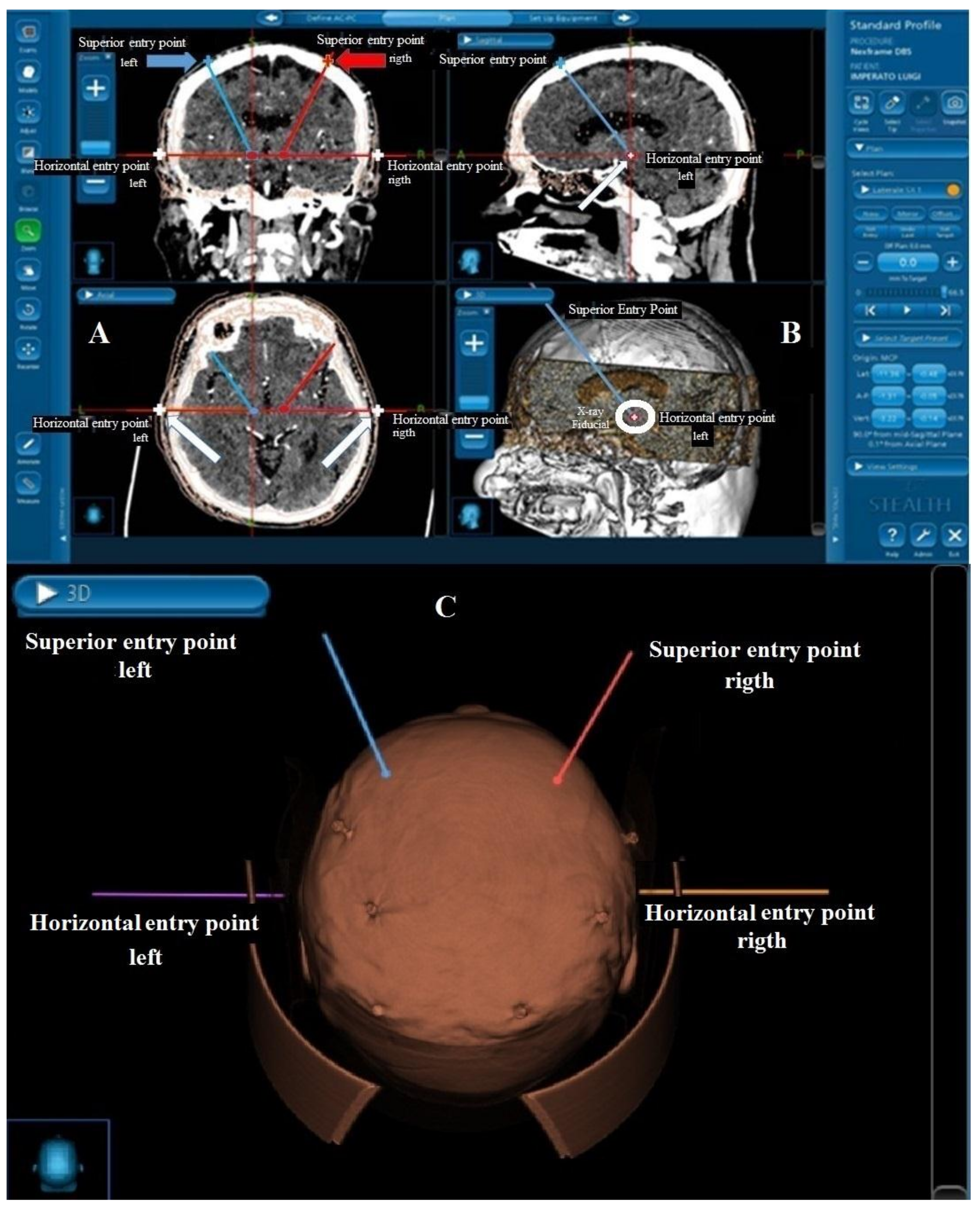 Brainsci 08 00090 g002