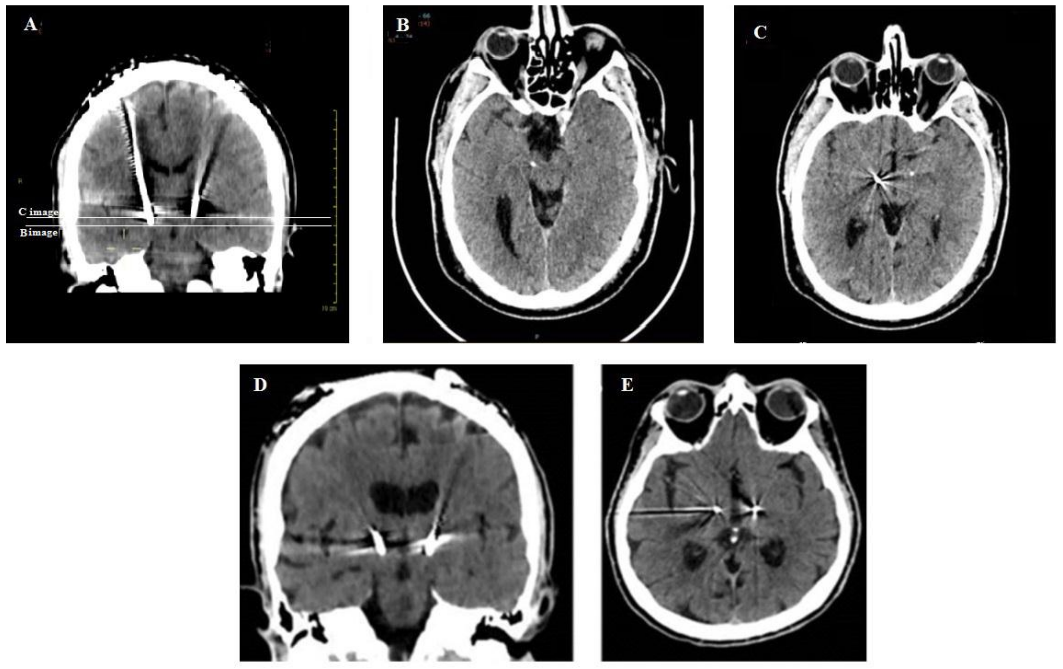 Brainsci 08 00090 g009