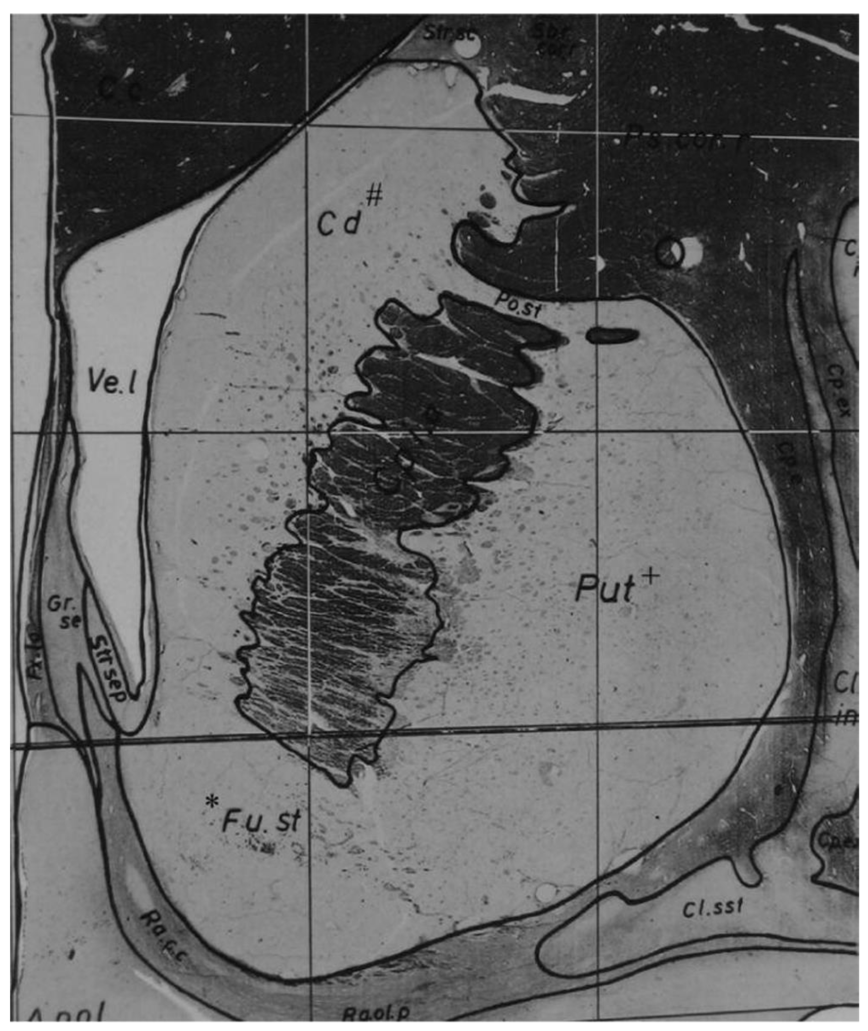 Brainsci 08 00095 g001
