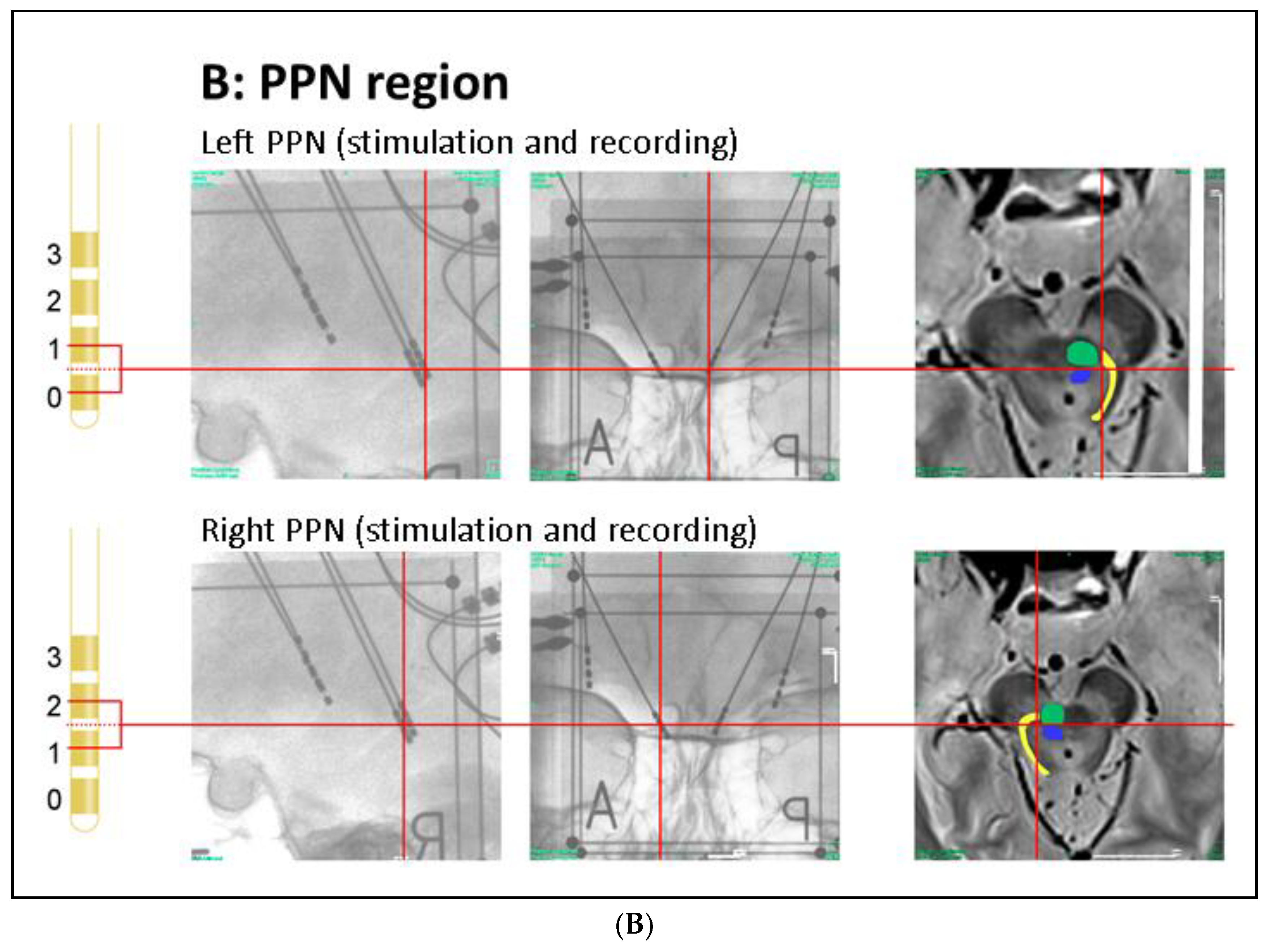 Brainsci 08 00117 g001b Brainsci 08 00117 g001b